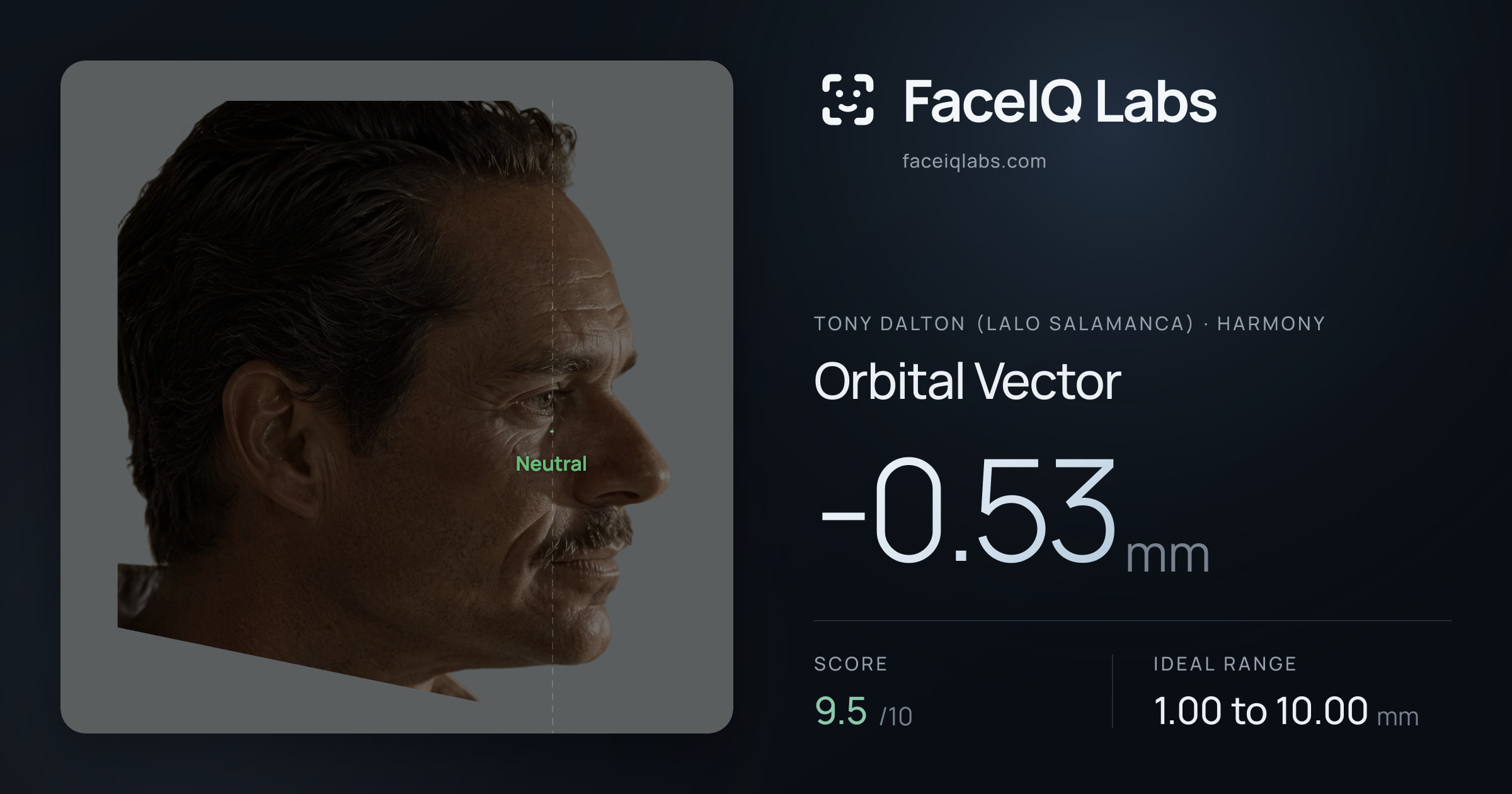 Tony Dalton (Lalo Salamanca) Orbital Vector: -0.53mm, drawn on the photo