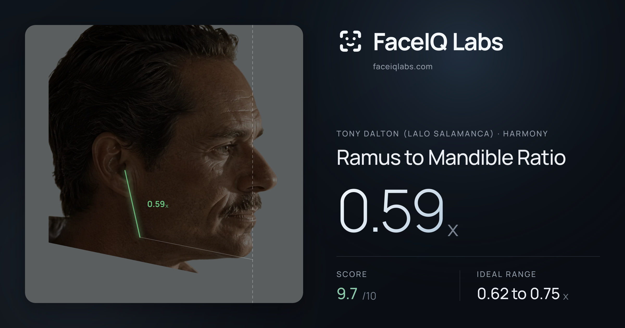 Tony Dalton (Lalo Salamanca) Ramus to Mandible Ratio: 0.59x, drawn on the photo