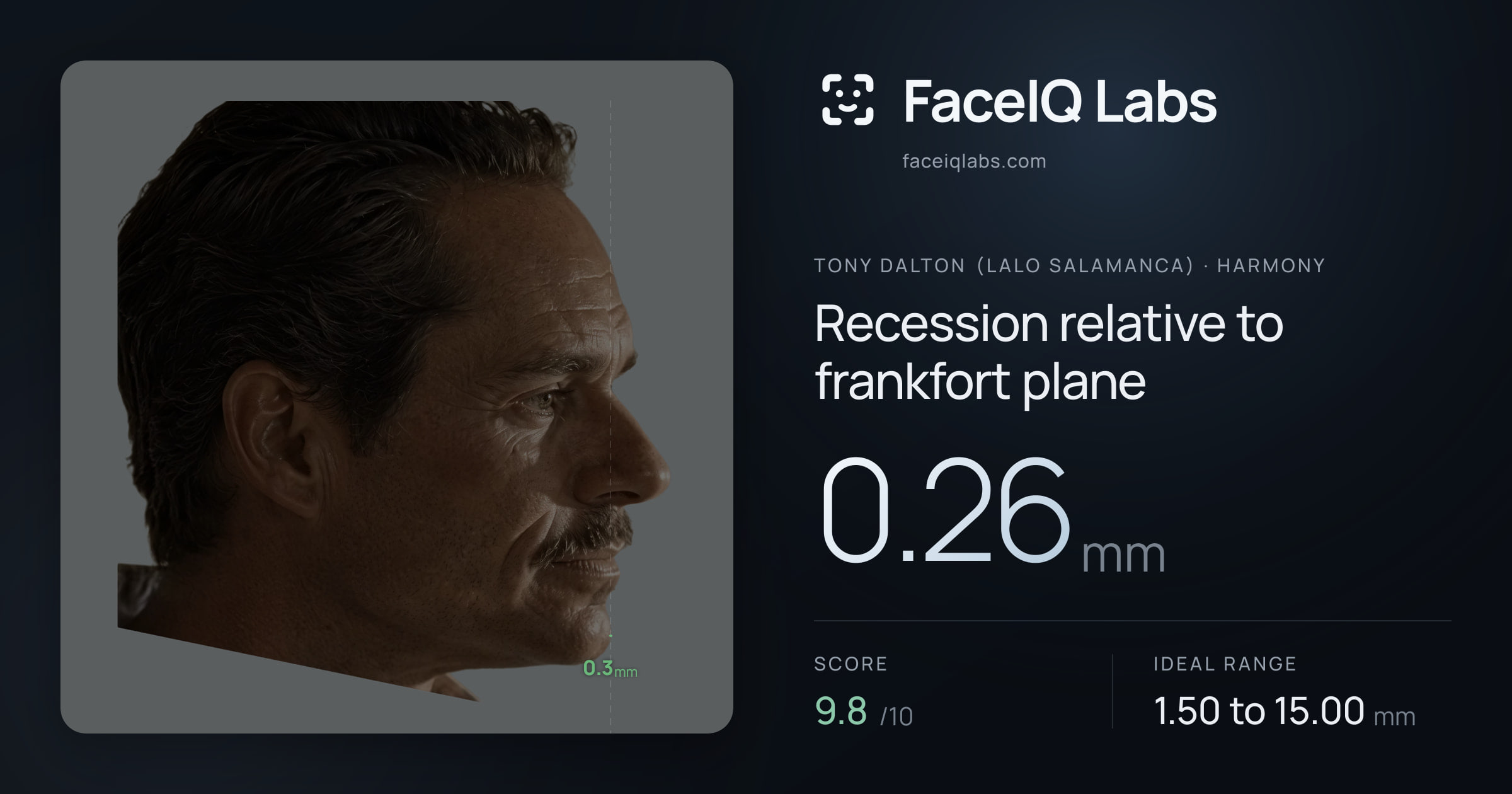 Tony Dalton (Lalo Salamanca) Recession relative to frankfort plane: 0.26mm, drawn on the photo