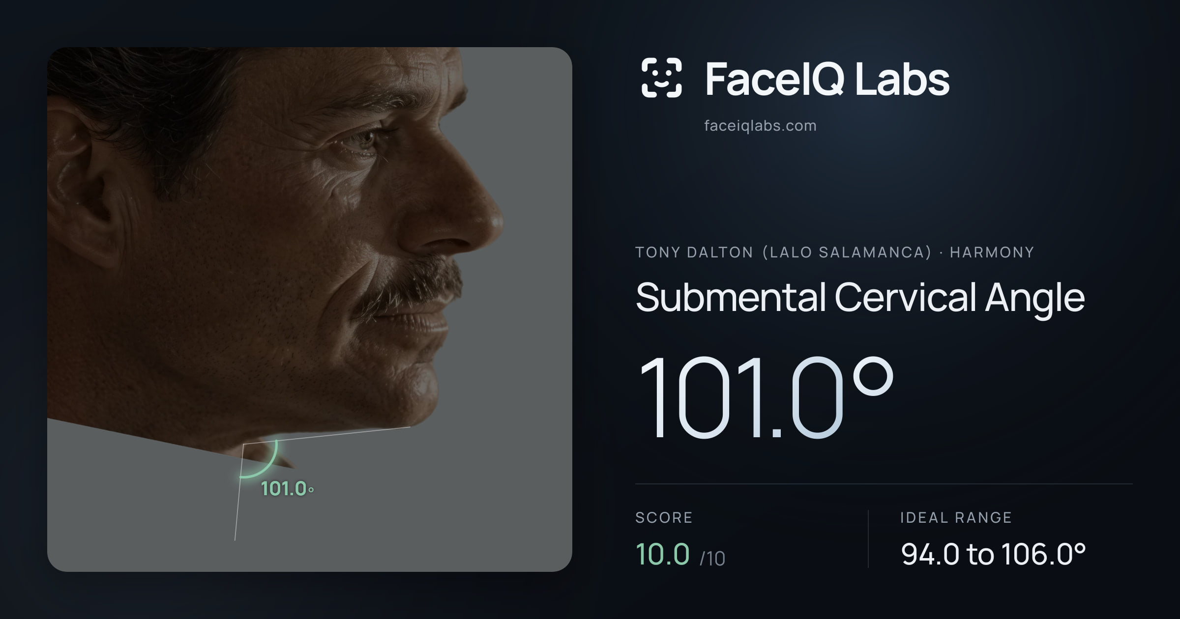 Tony Dalton (Lalo Salamanca) Submental Cervical Angle: 101.0°, drawn on the photo