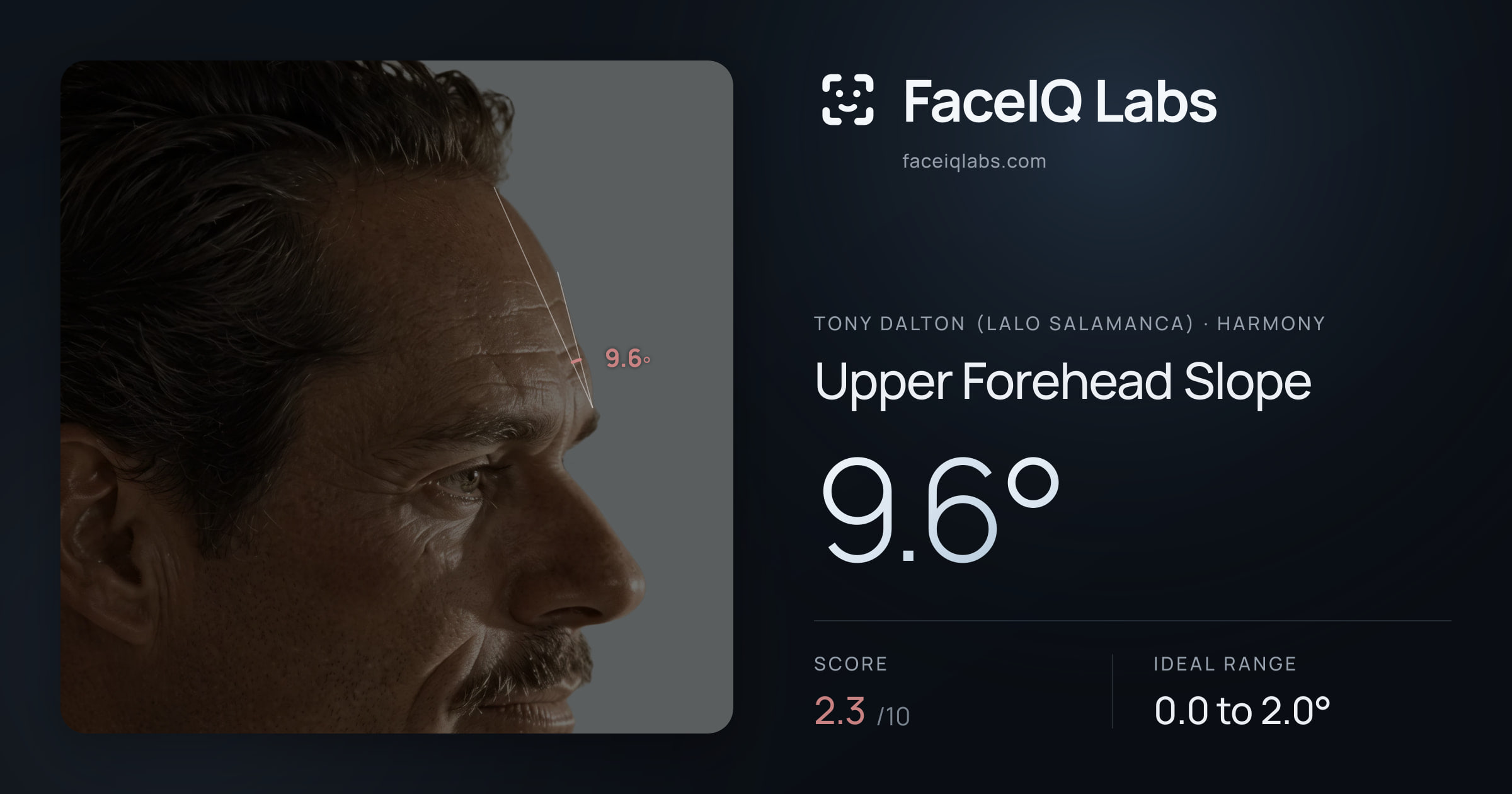 Tony Dalton (Lalo Salamanca) Upper Forehead Slope: 9.6°, drawn on the photo