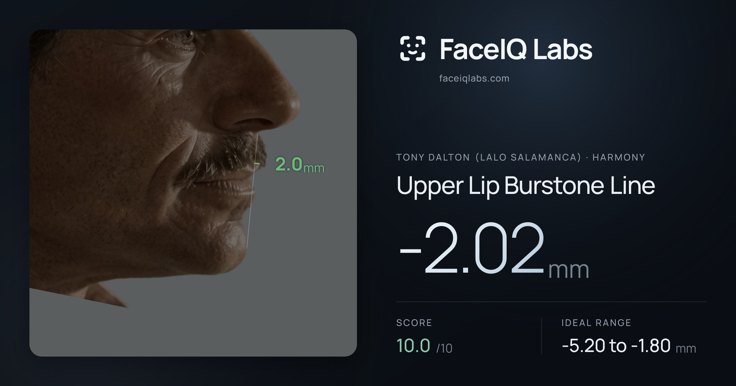 Tony Dalton (Lalo Salamanca) Upper Lip Burstone Line: -2.02mm, drawn on the photo