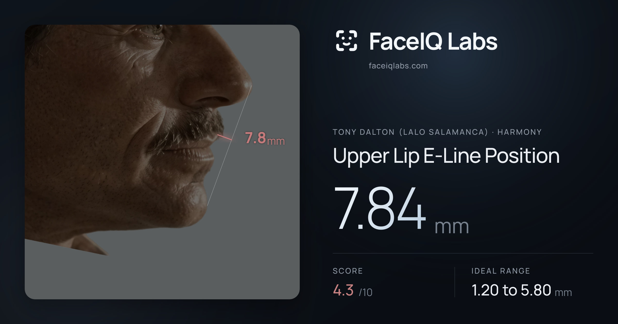 Tony Dalton (Lalo Salamanca) Upper Lip E-Line Position: 7.84mm, drawn on the photo