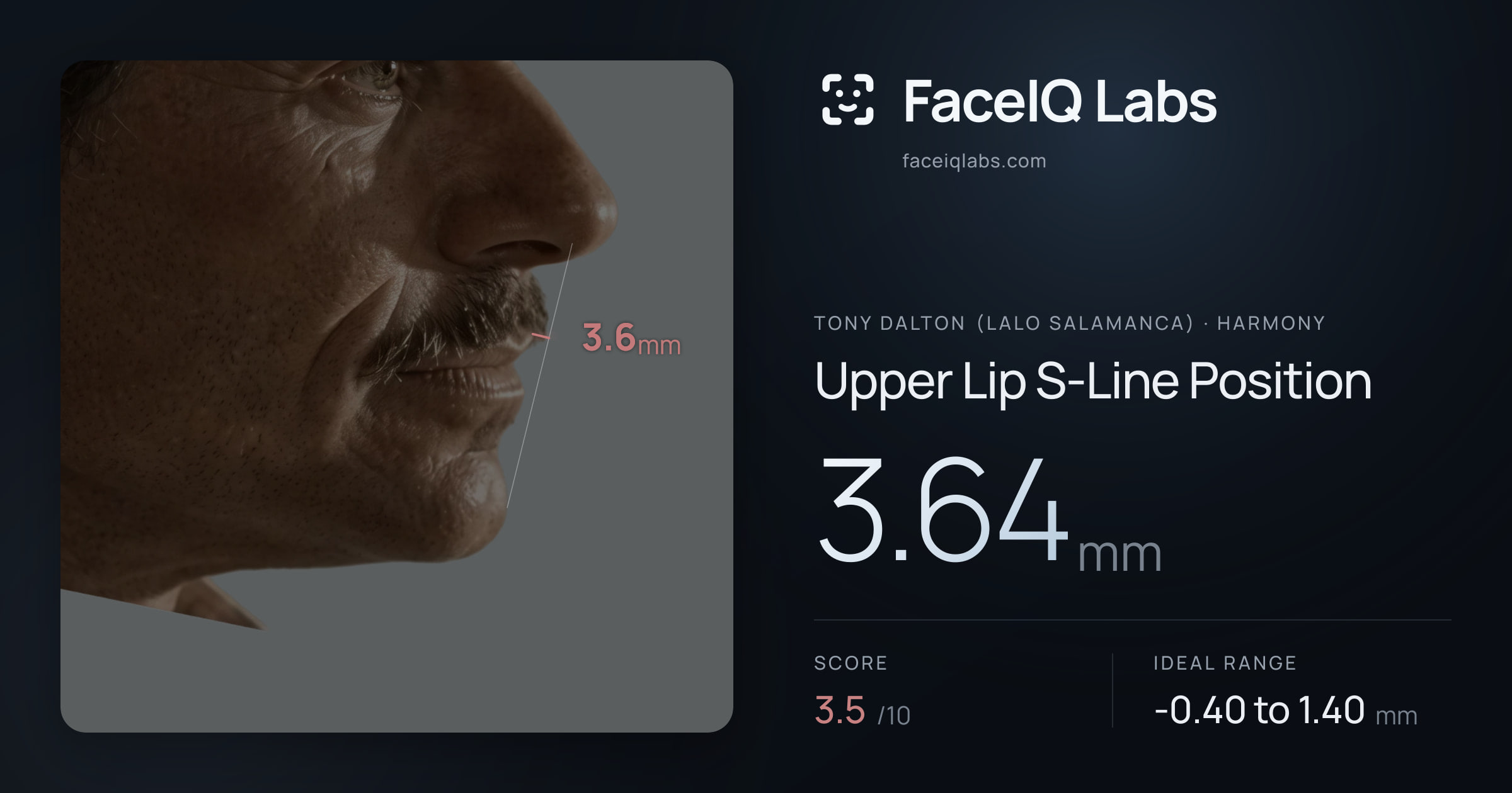 Tony Dalton (Lalo Salamanca) Upper Lip S-Line Position: 3.64mm, drawn on the photo