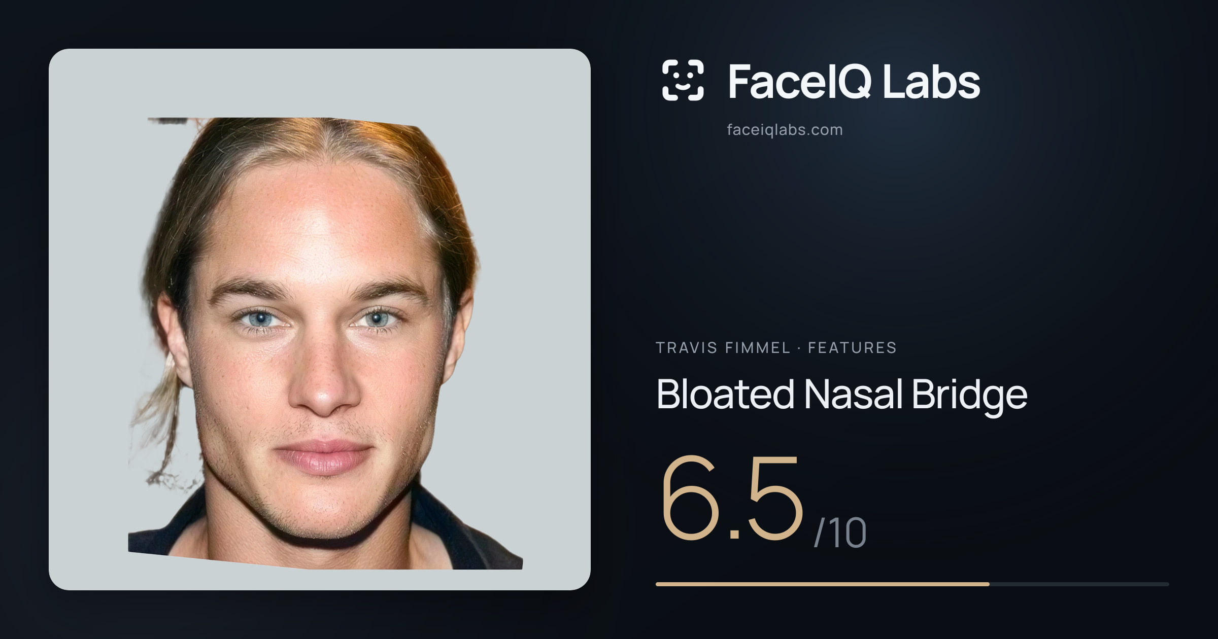 Travis Fimmel Bloated Nasal Bridge: 6.5/10, drawn on the photo