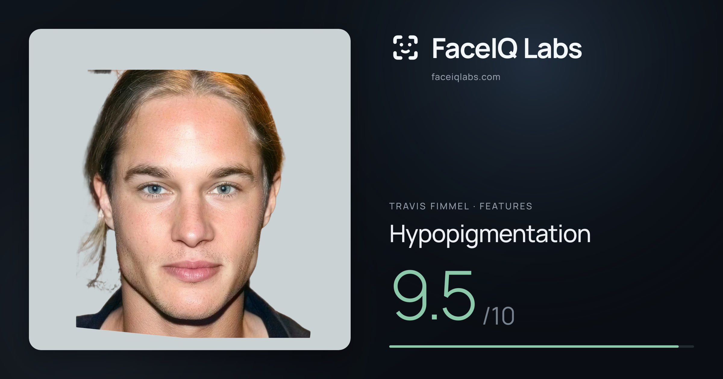 Travis Fimmel Hypopigmentation: 9.5/10, drawn on the photo