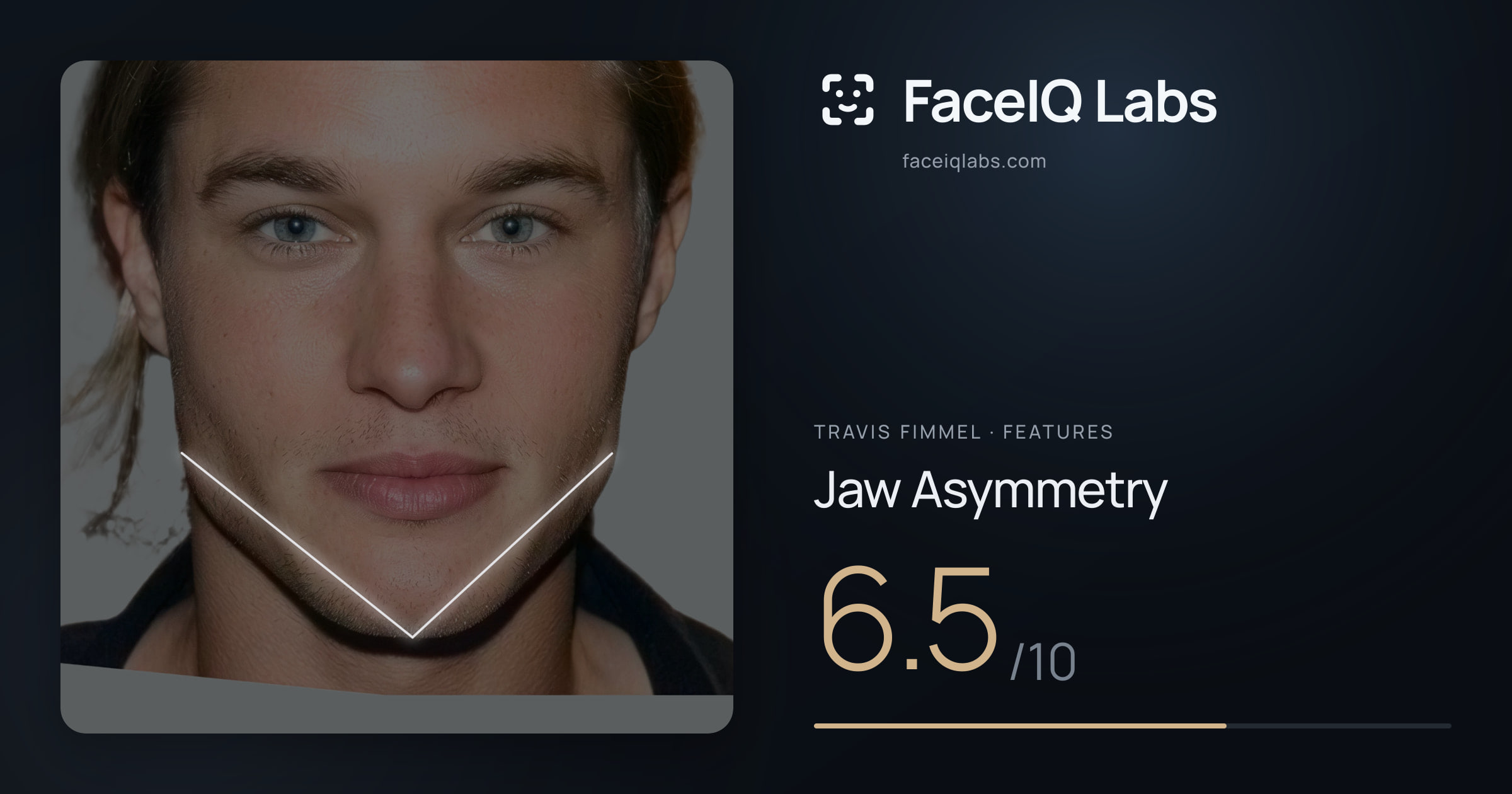 Travis Fimmel Jaw Asymmetry: 6.5/10, drawn on the photo