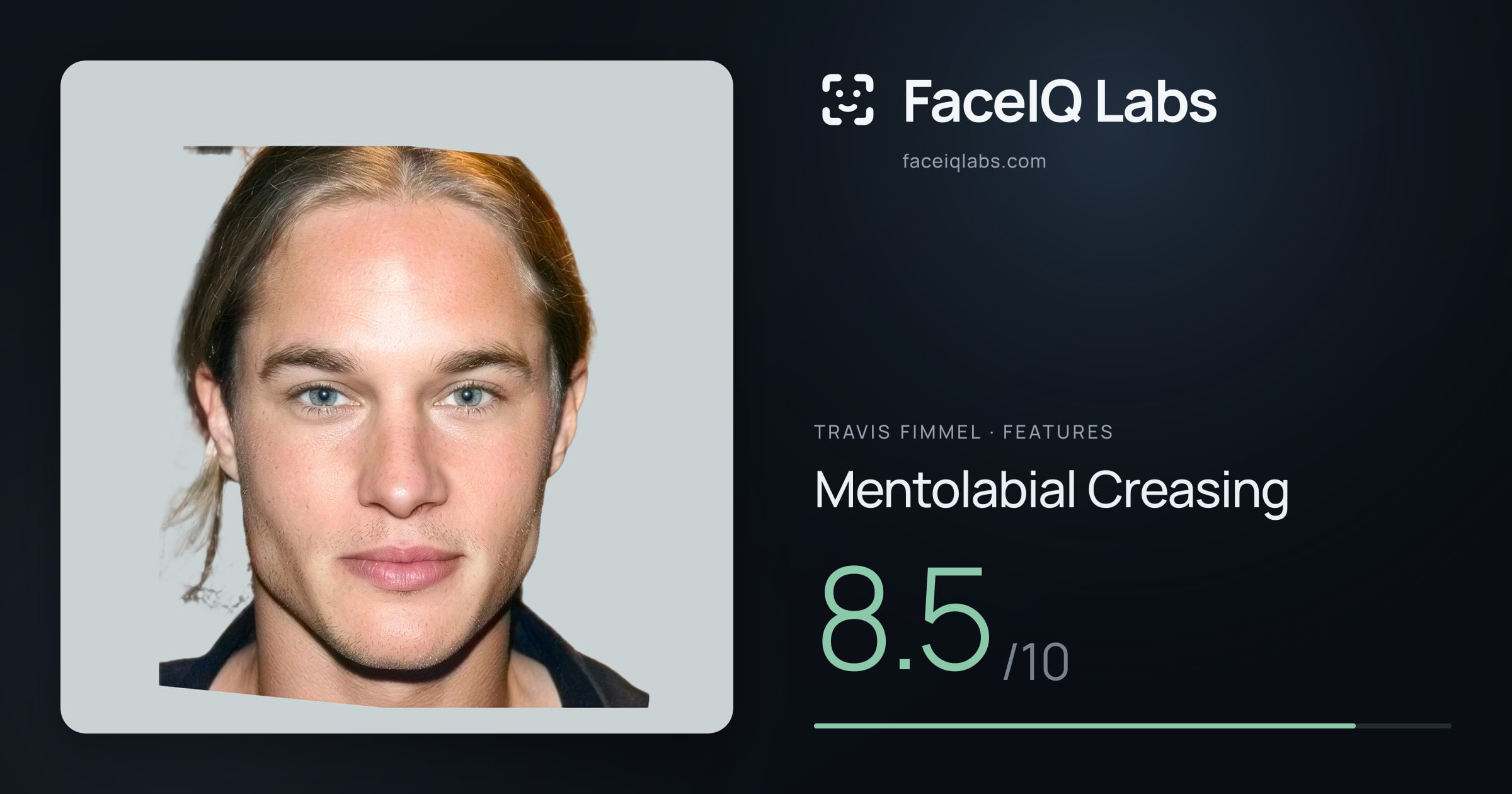 Travis Fimmel Mentolabial Creasing: 8.5/10, drawn on the photo