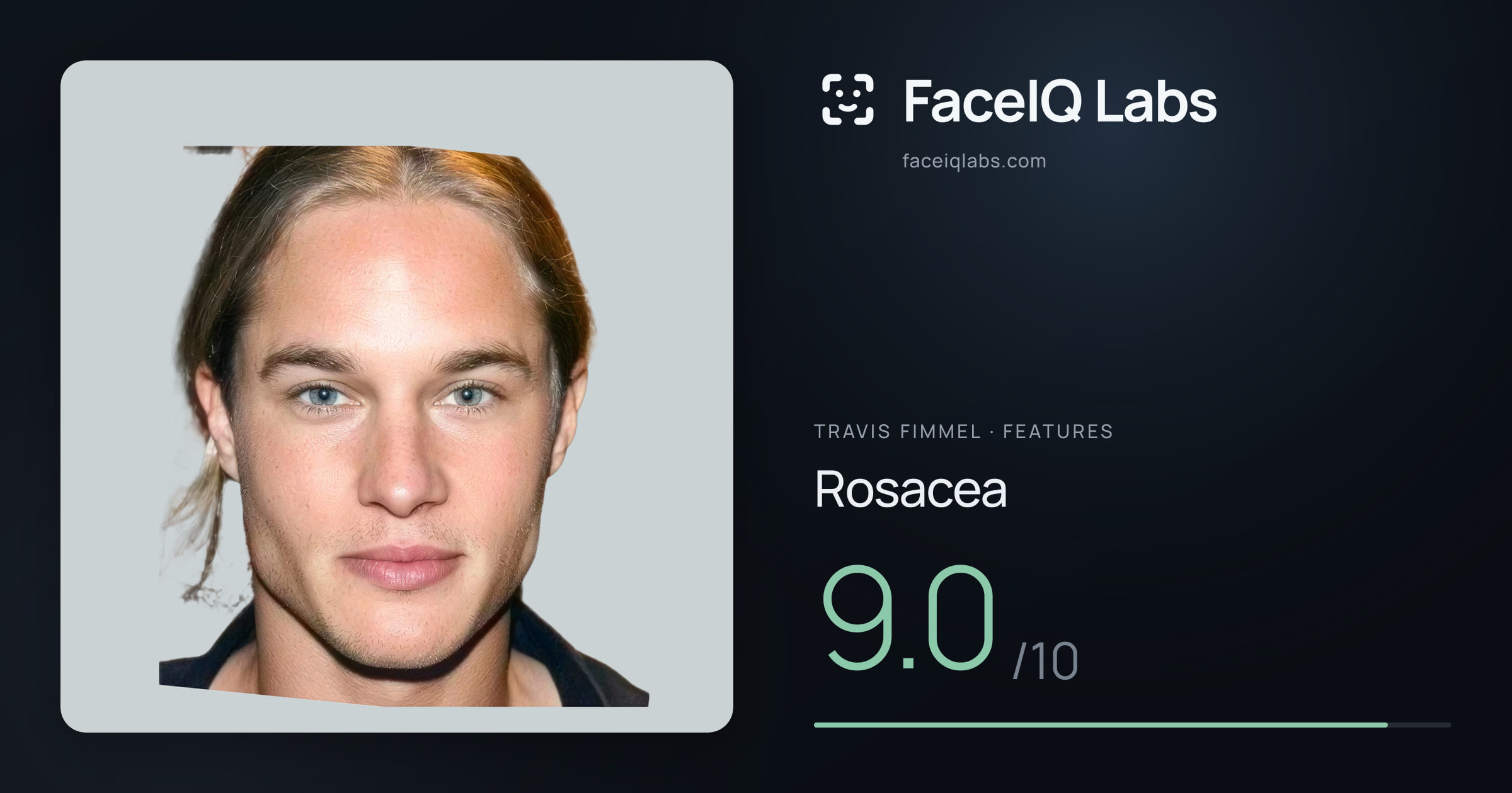 Travis Fimmel Rosacea: 9.0/10, drawn on the photo