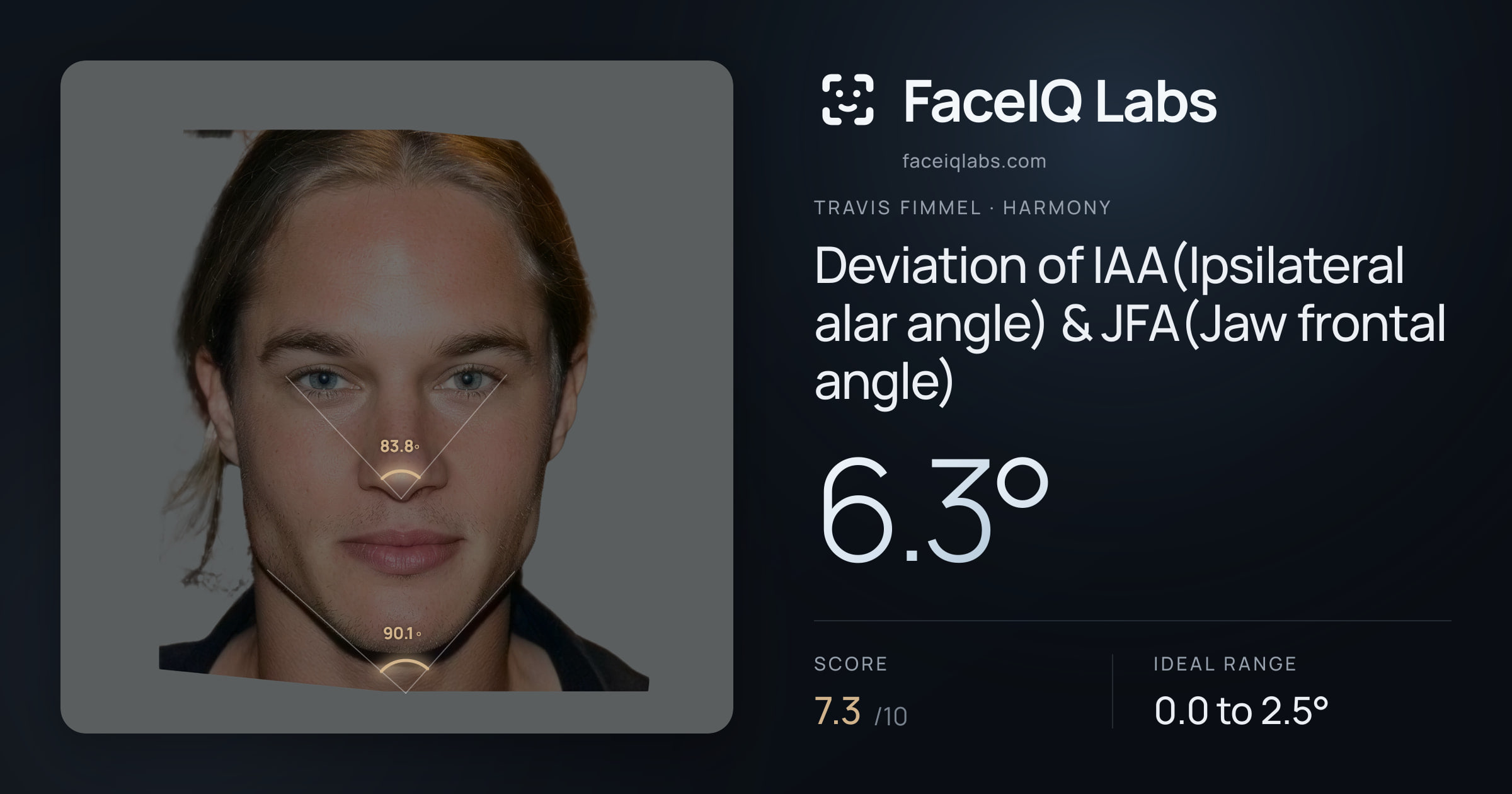 Travis Fimmel Deviation of IAA(Ipsilateral alar angle) & JFA(Jaw frontal angle): 6.3°, drawn on the photo