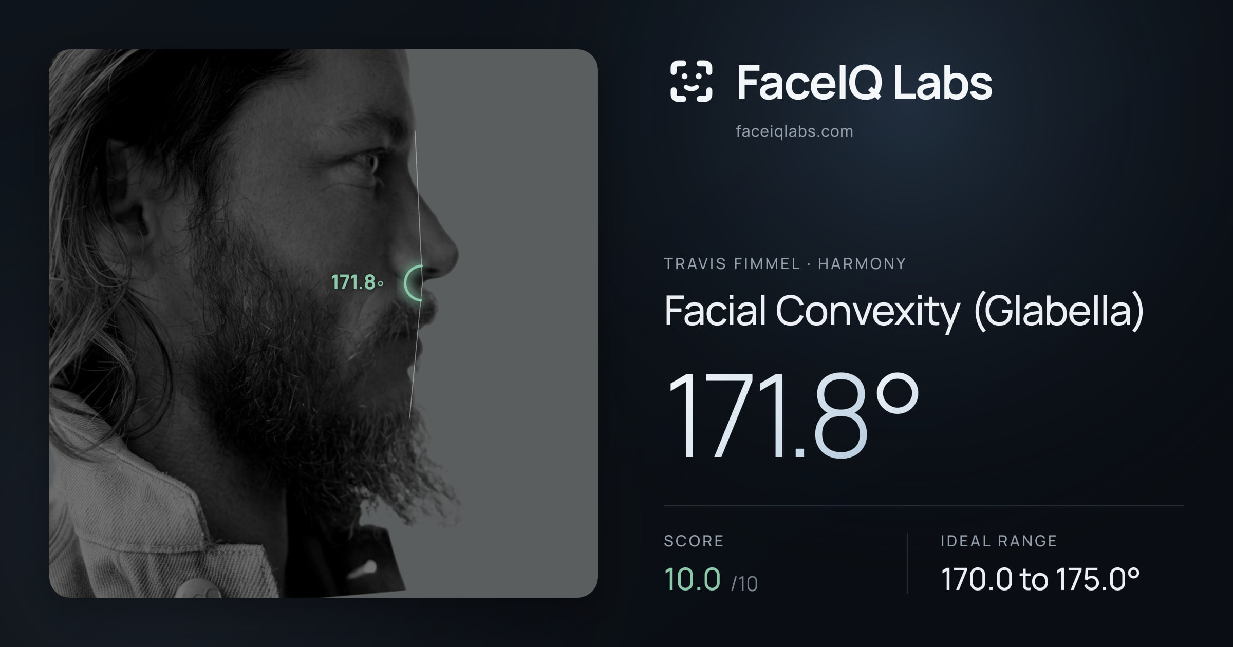 Travis Fimmel Facial Convexity (Glabella): 171.8°, drawn on the photo