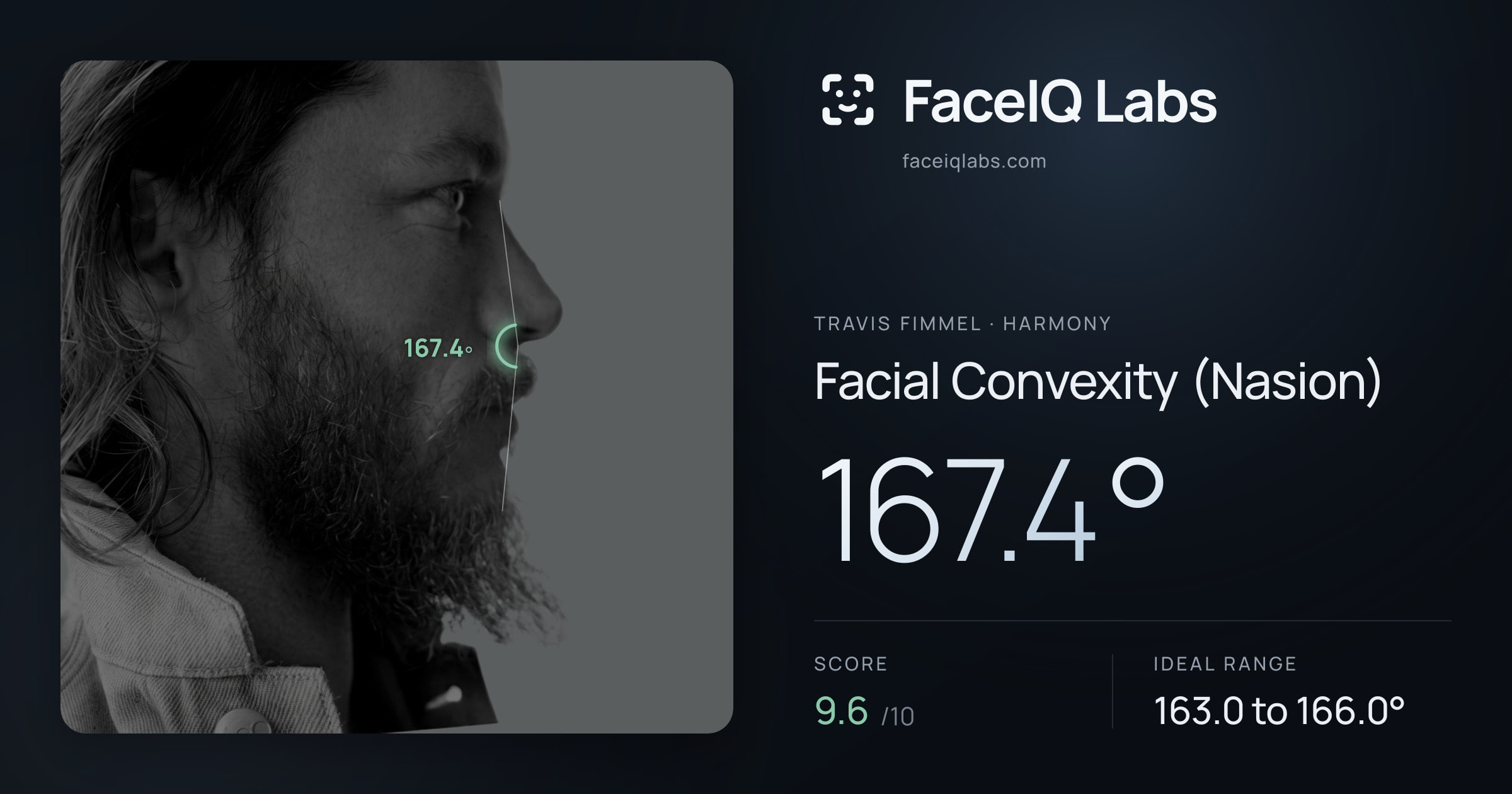 Travis Fimmel Facial Convexity (Nasion): 167.4°, drawn on the photo