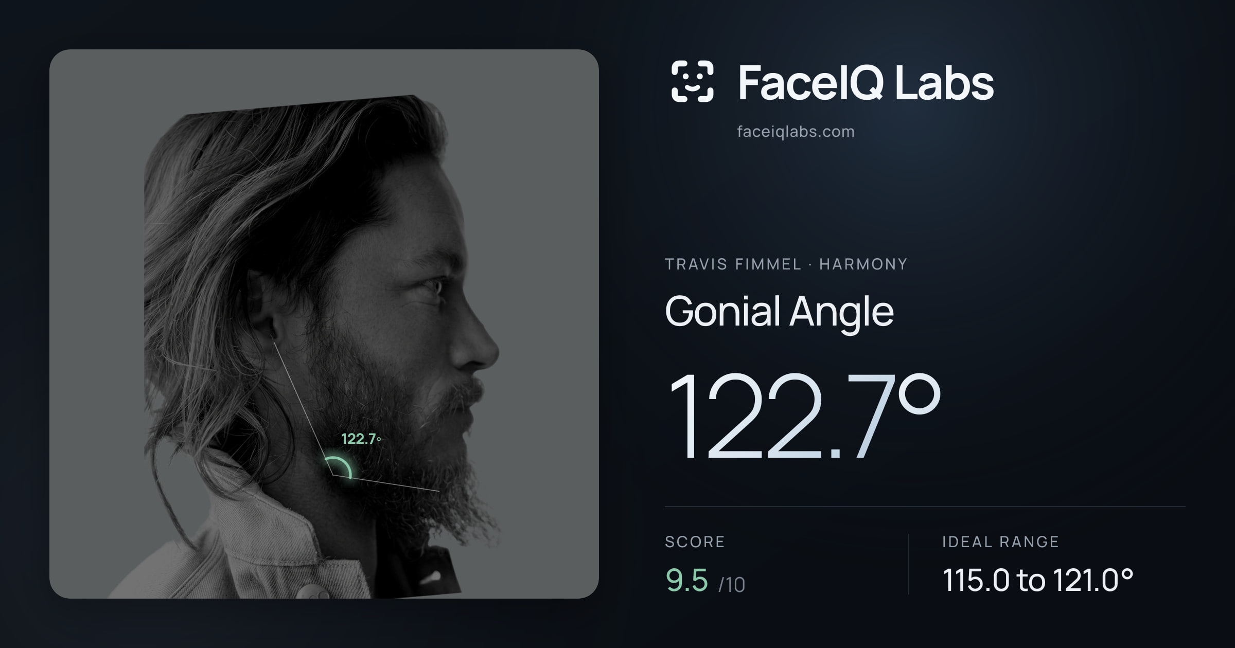 Travis Fimmel Gonial Angle: 122.7°, drawn on the photo