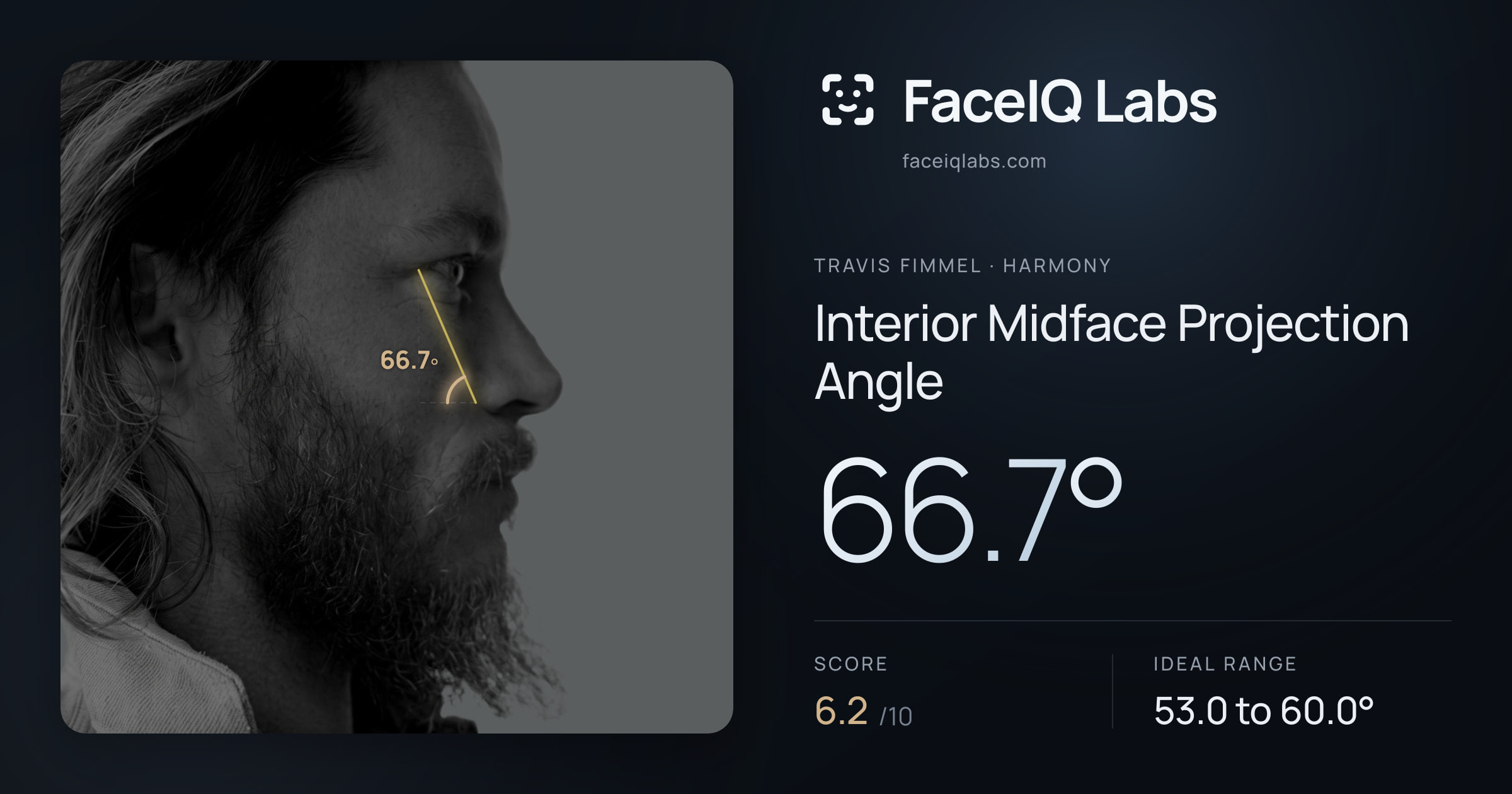 Travis Fimmel Interior Midface Projection Angle: 66.7°, drawn on the photo