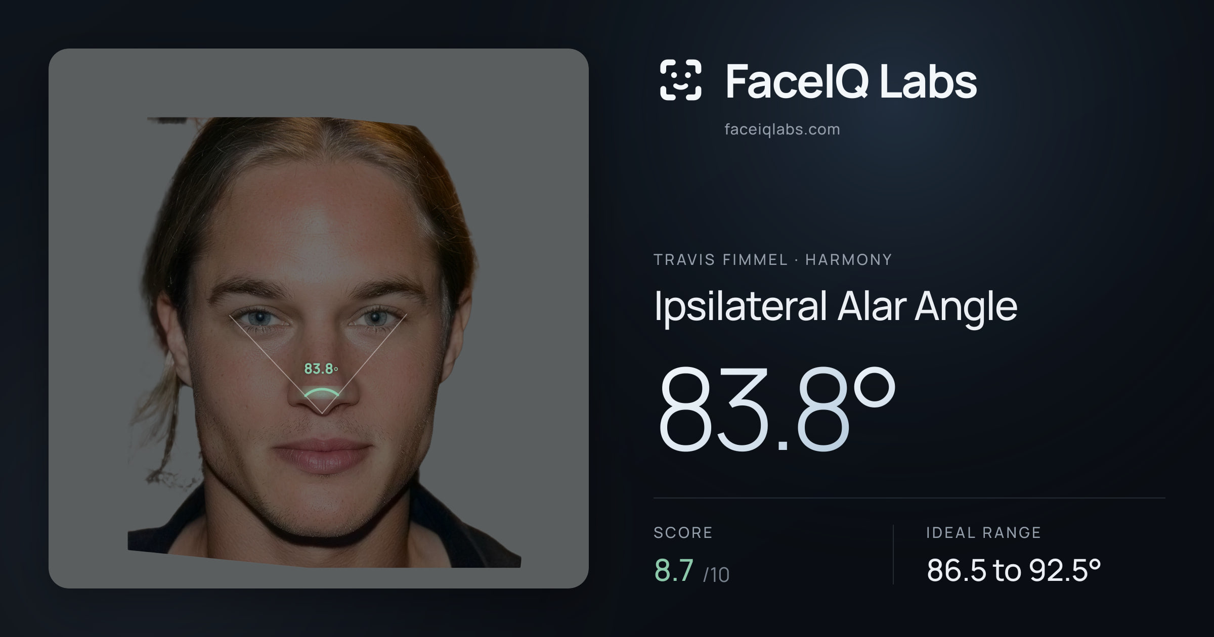 Travis Fimmel Ipsilateral Alar Angle: 83.8°, drawn on the photo