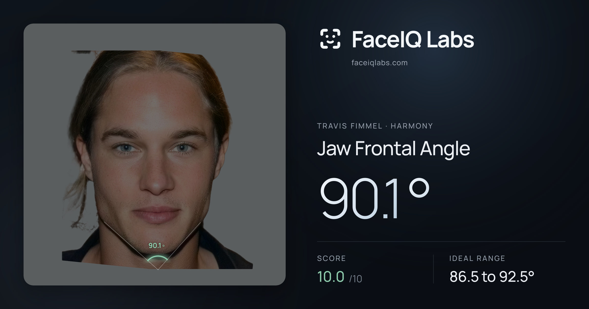Travis Fimmel Jaw Frontal Angle: 90.1°, drawn on the photo