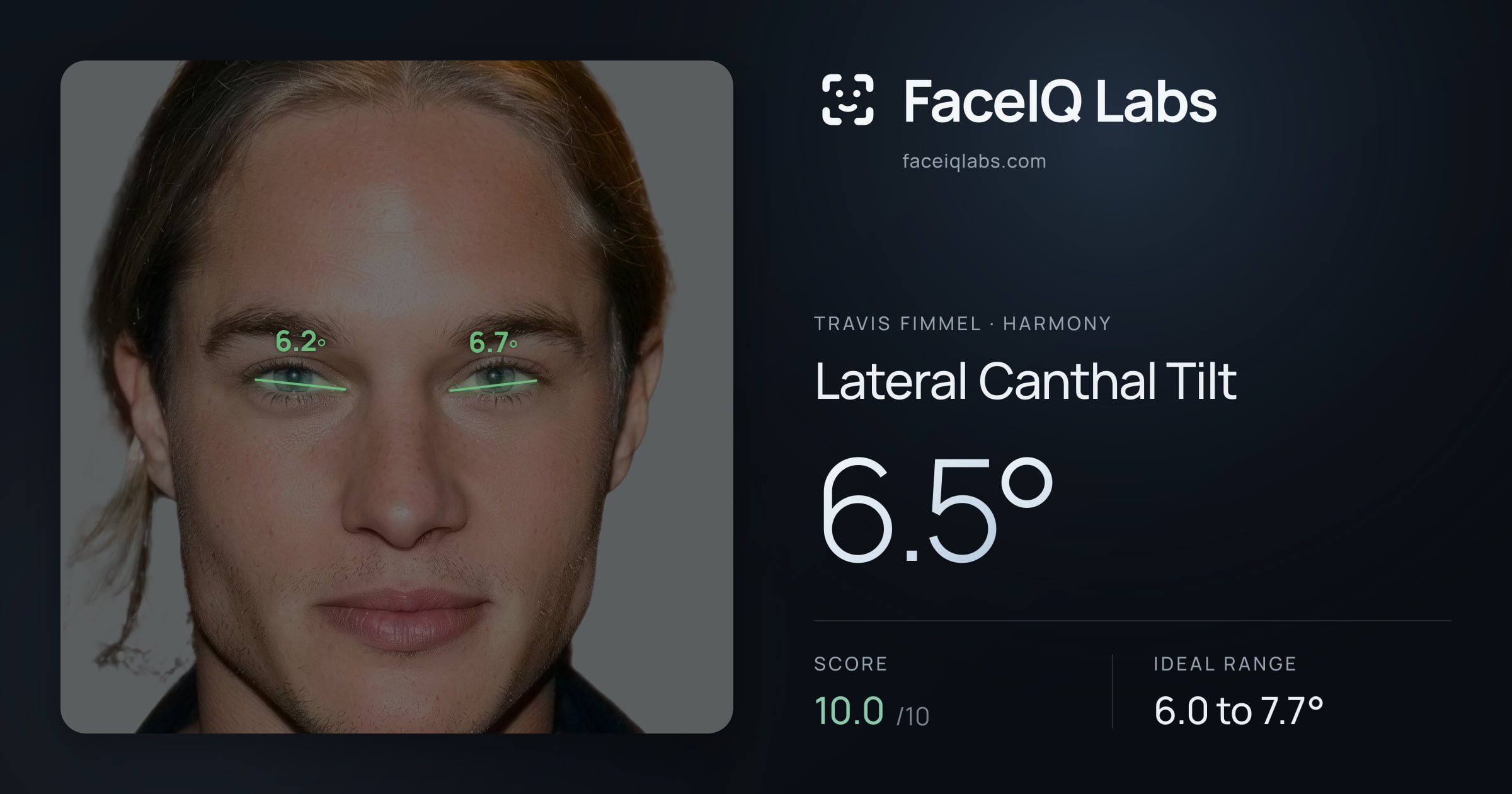Travis Fimmel Lateral Canthal Tilt: 6.5°, drawn on the photo