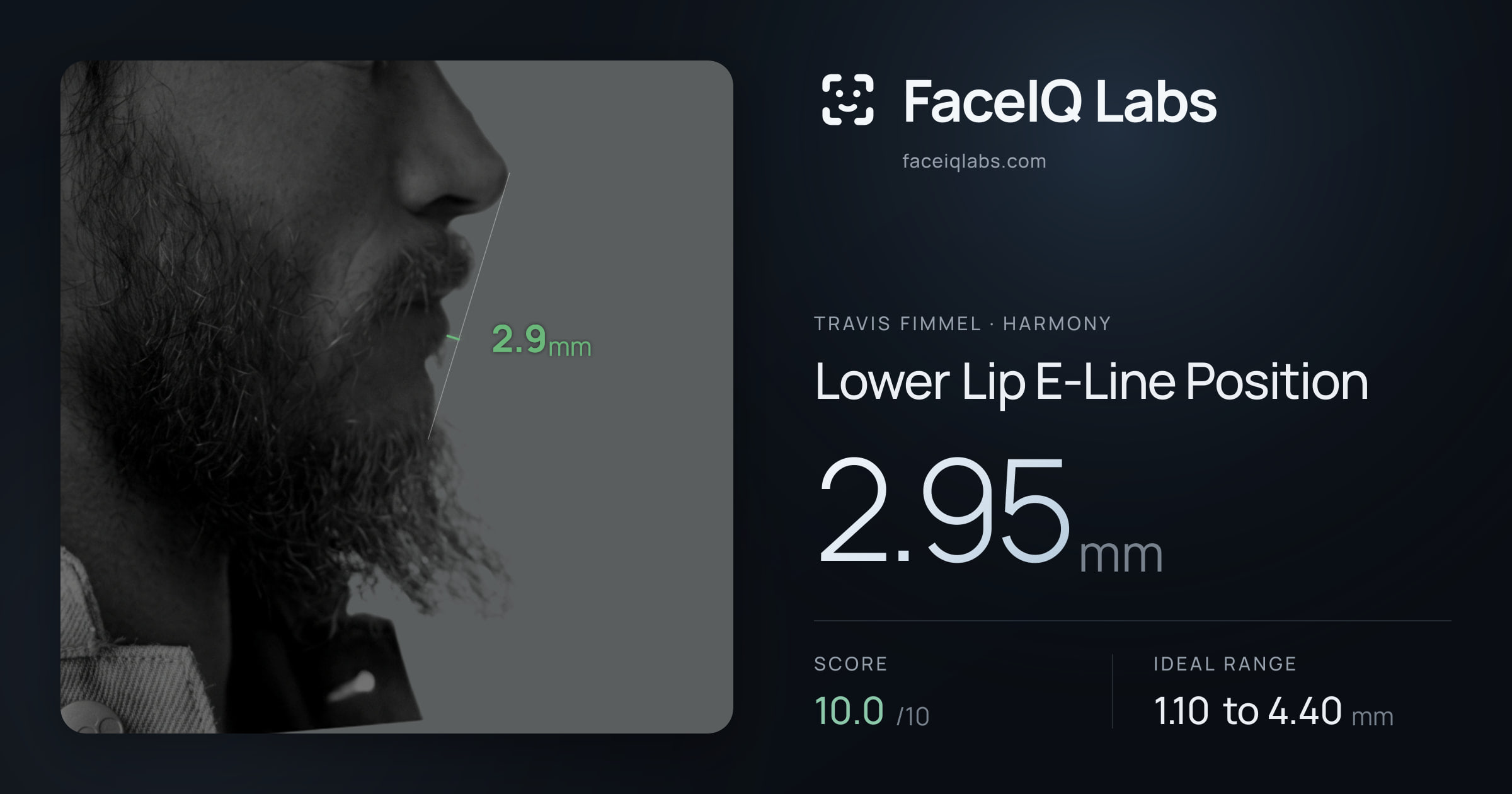 Travis Fimmel Lower Lip E-Line Position: 2.95mm, drawn on the photo