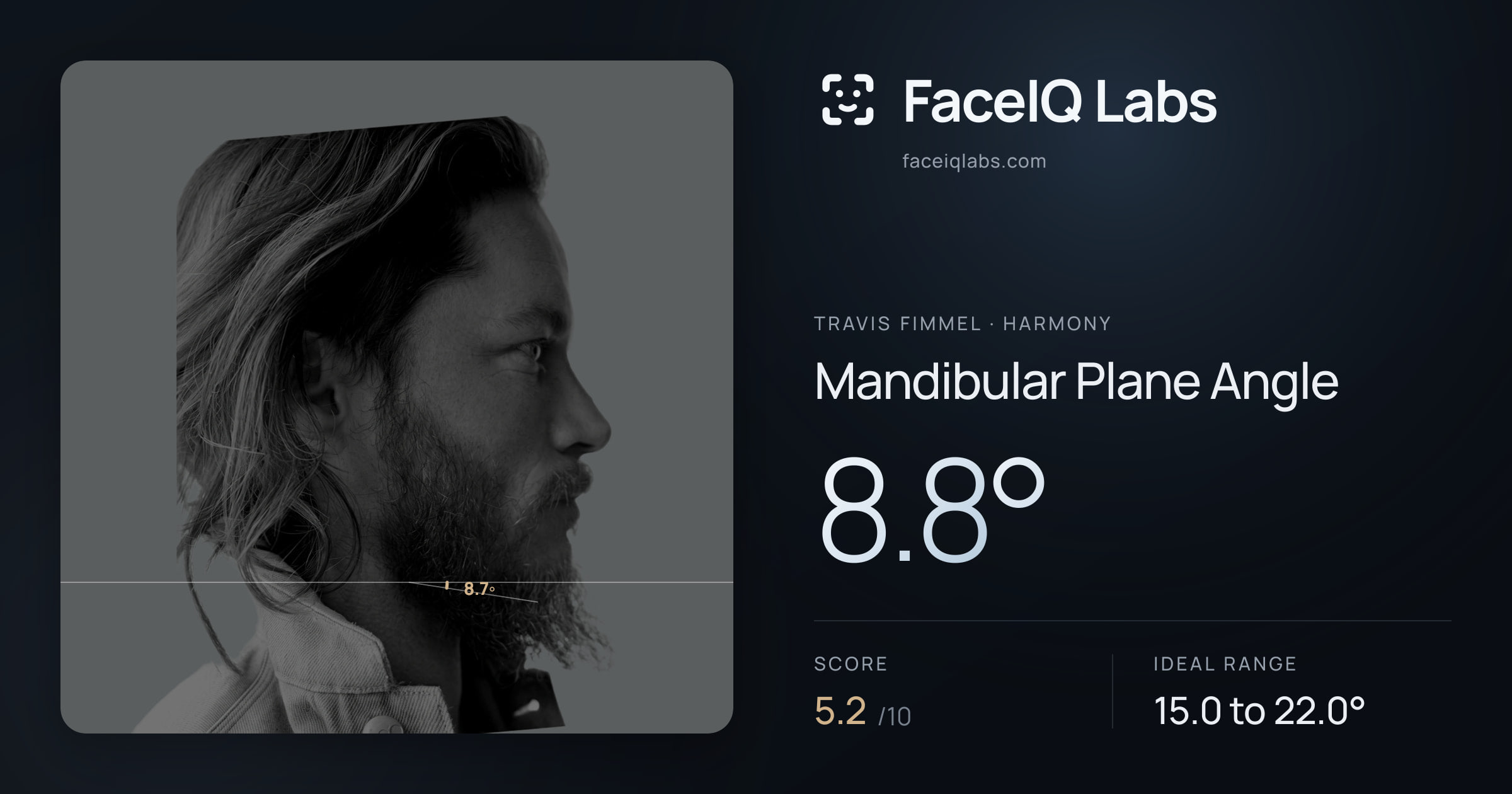 Travis Fimmel Mandibular Plane Angle: 8.8°, drawn on the photo