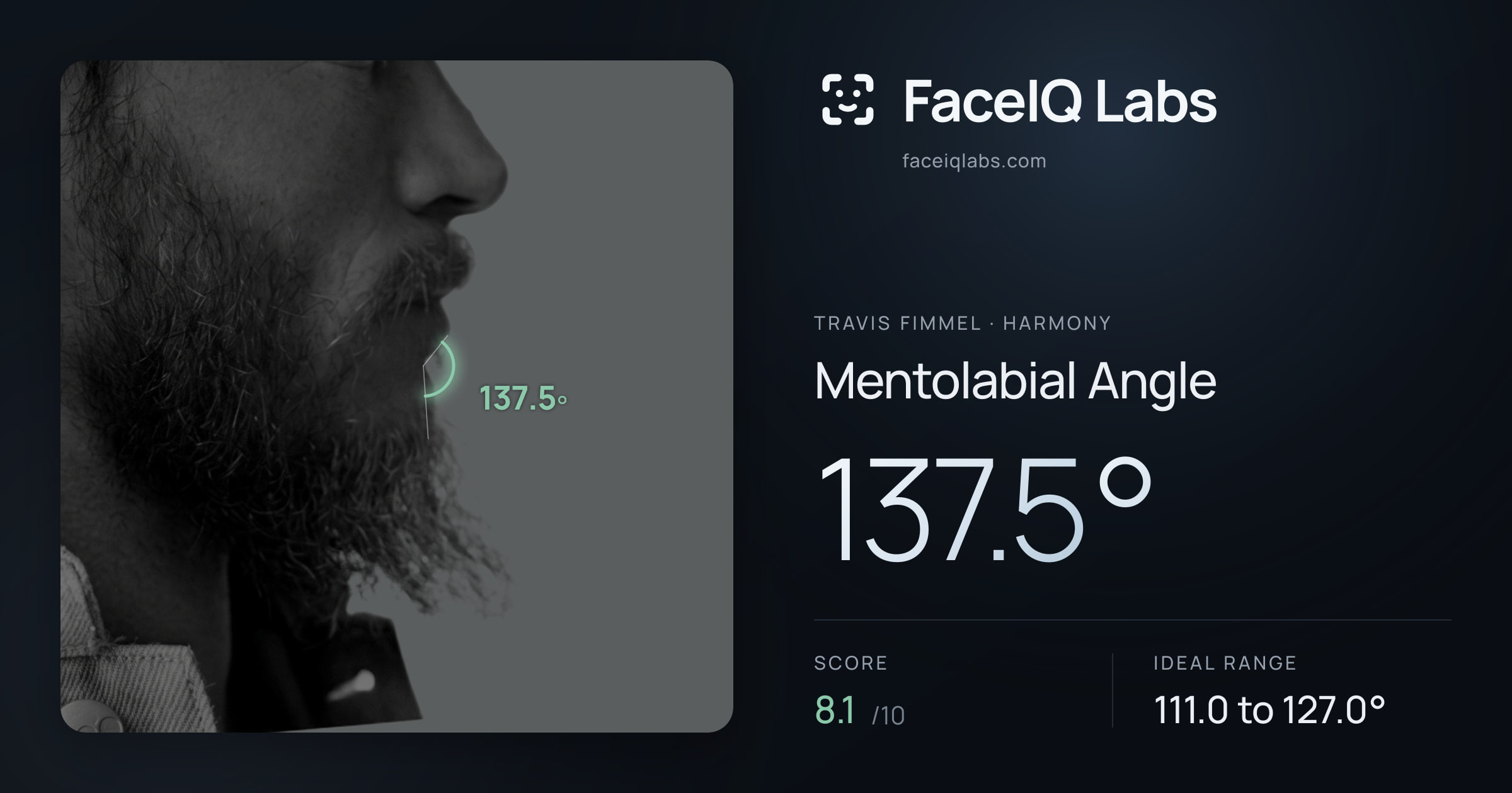 Travis Fimmel Mentolabial Angle: 137.5°, drawn on the photo