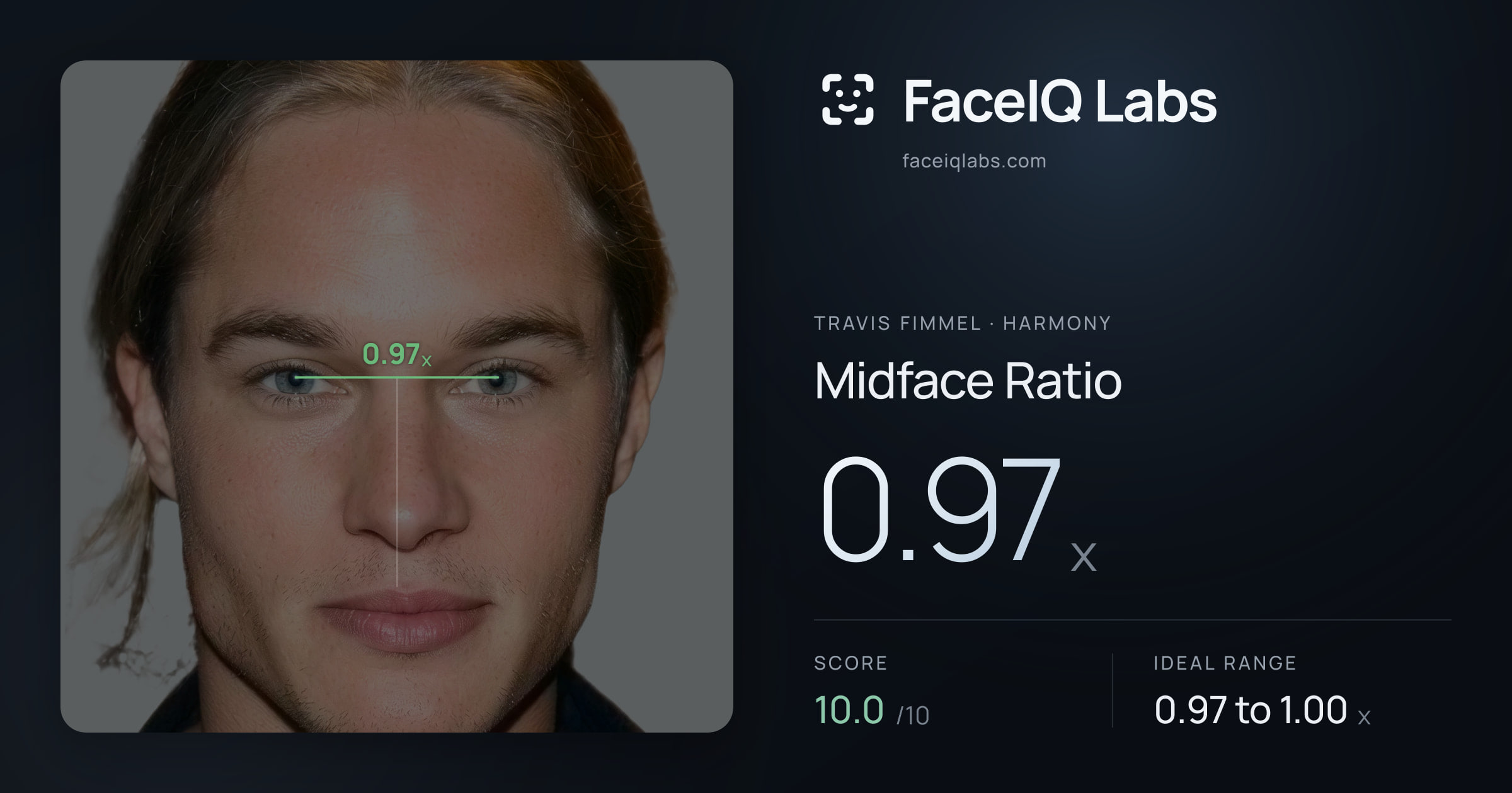 Travis Fimmel Midface Ratio: 0.97x, drawn on the photo