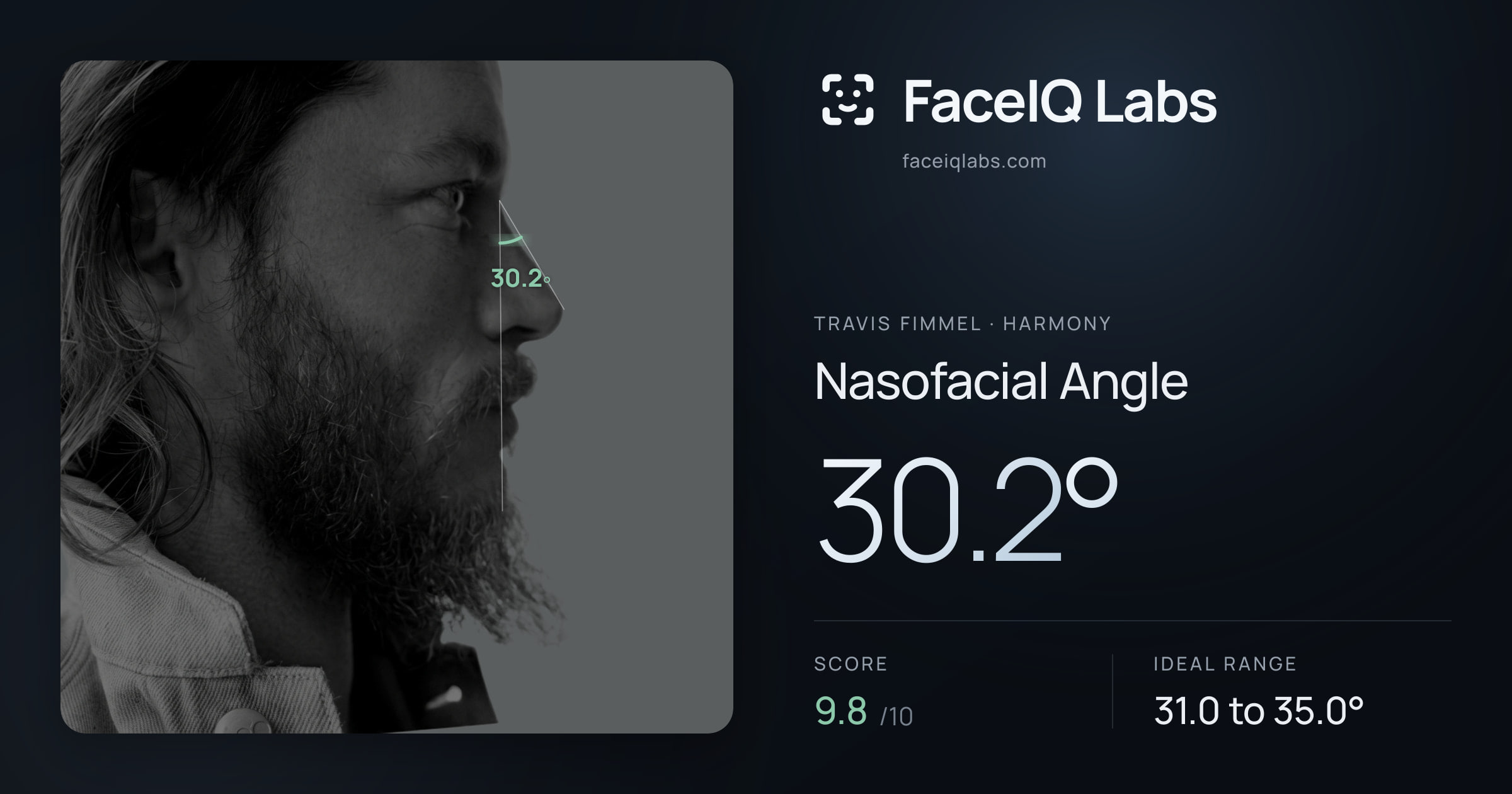 Travis Fimmel Nasofacial Angle: 30.2°, drawn on the photo