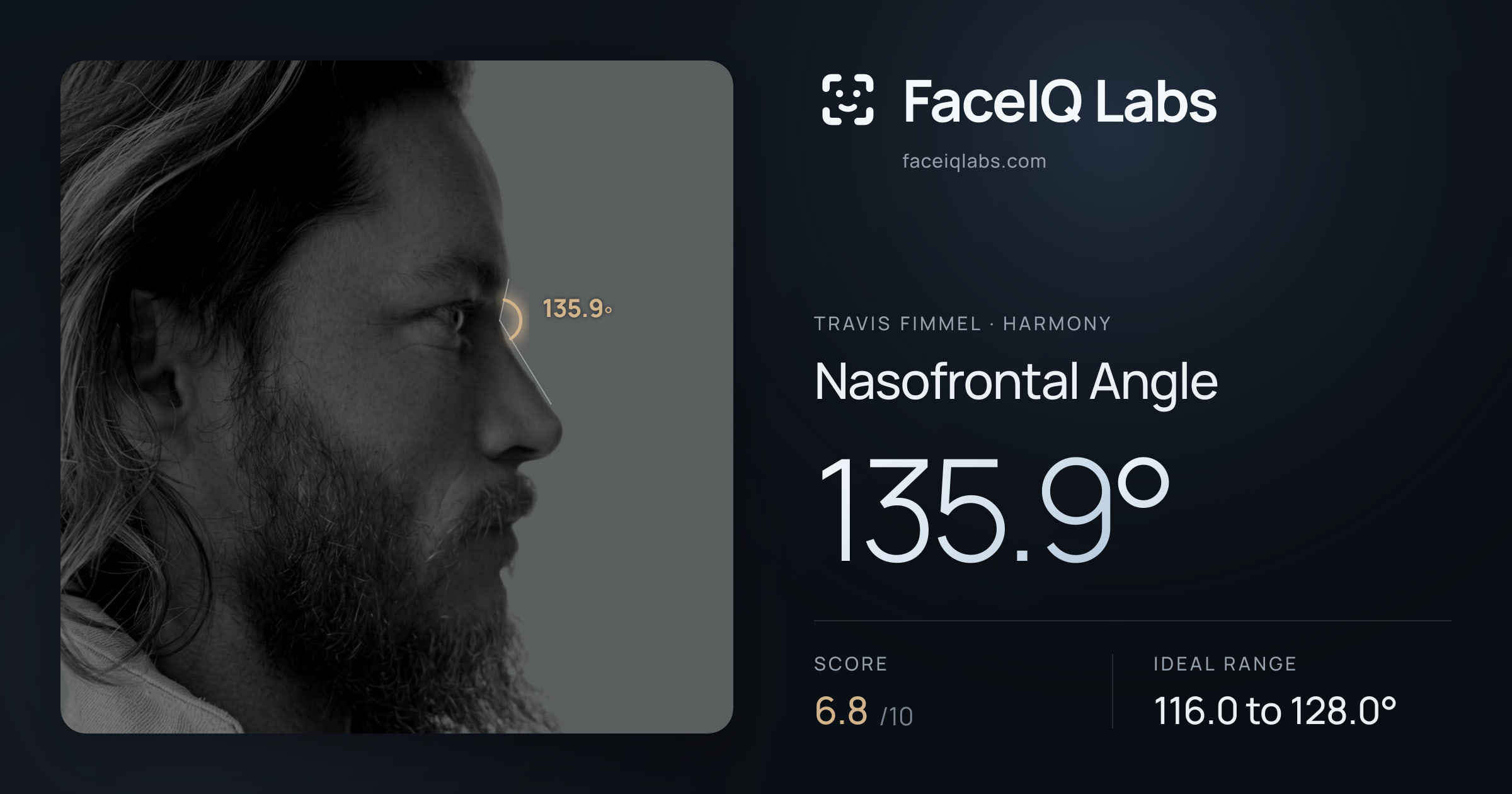 Travis Fimmel Nasofrontal Angle: 135.9°, drawn on the photo