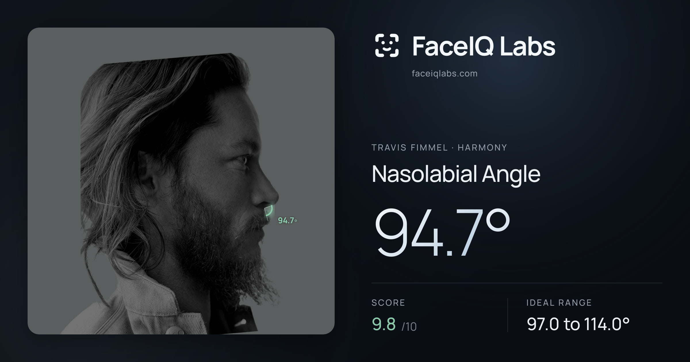 Travis Fimmel Nasolabial Angle: 94.7°, drawn on the photo
