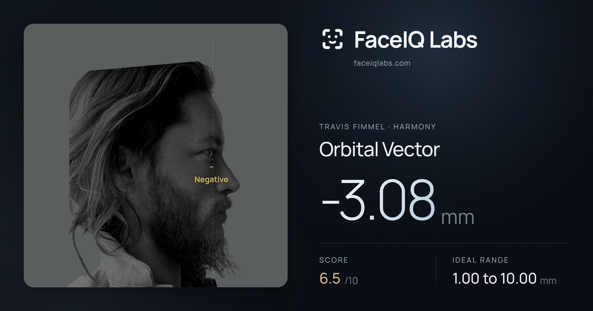Travis Fimmel Orbital Vector: -3.08mm, drawn on the photo