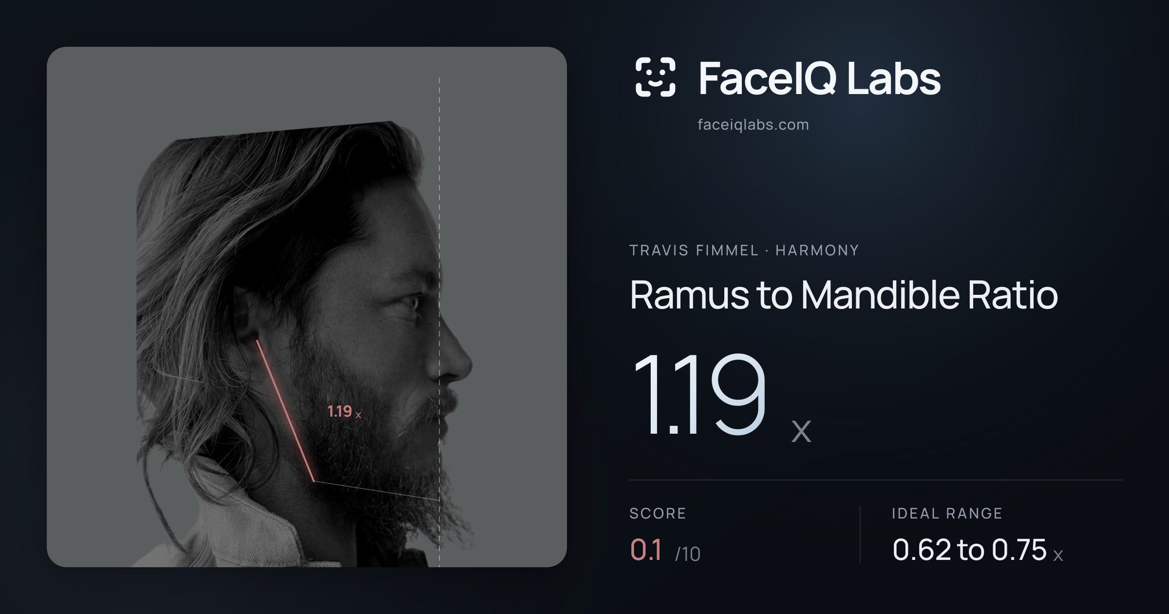 Travis Fimmel Ramus to Mandible Ratio: 1.19x, drawn on the photo