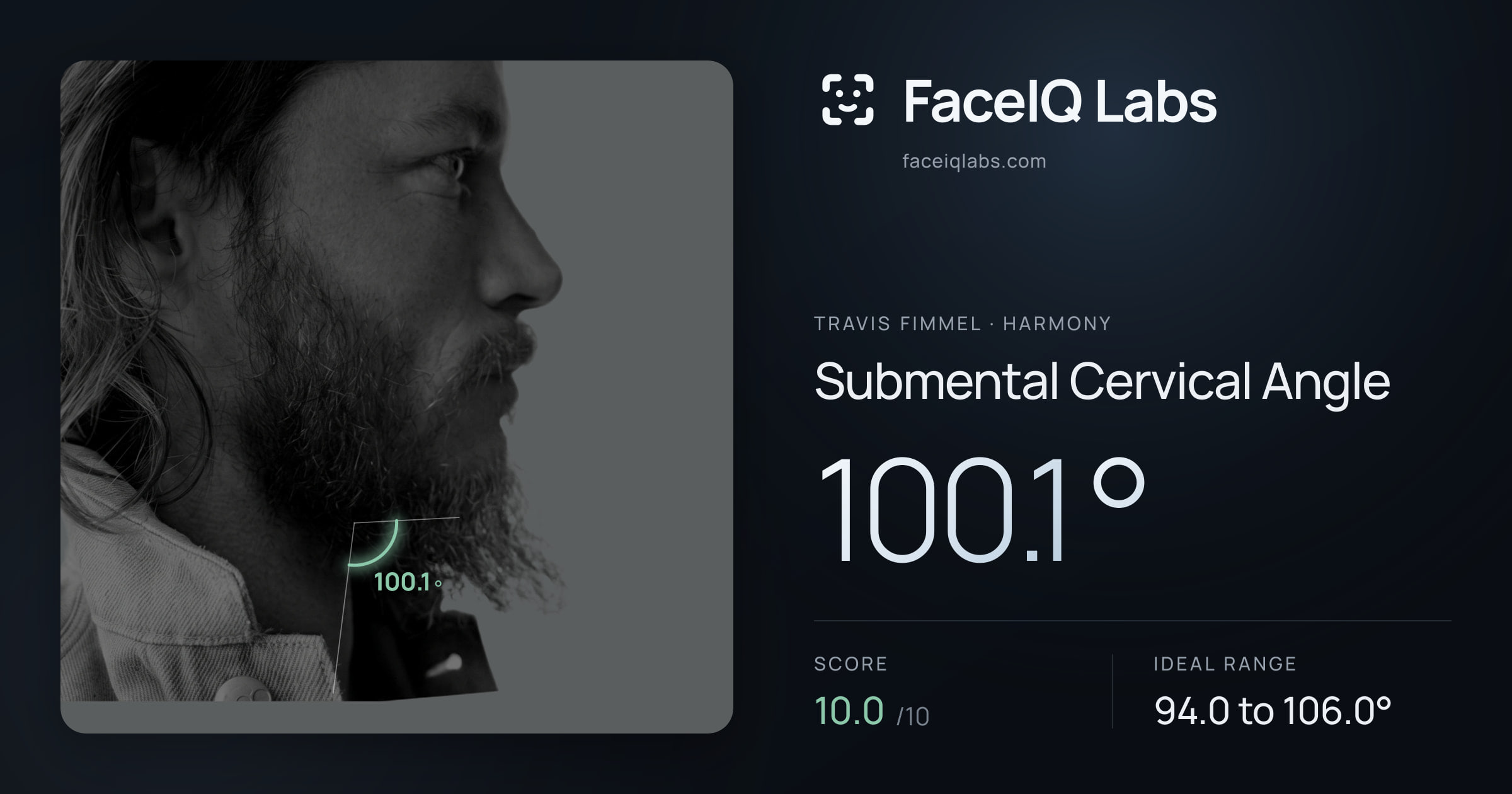 Travis Fimmel Submental Cervical Angle: 100.1°, drawn on the photo