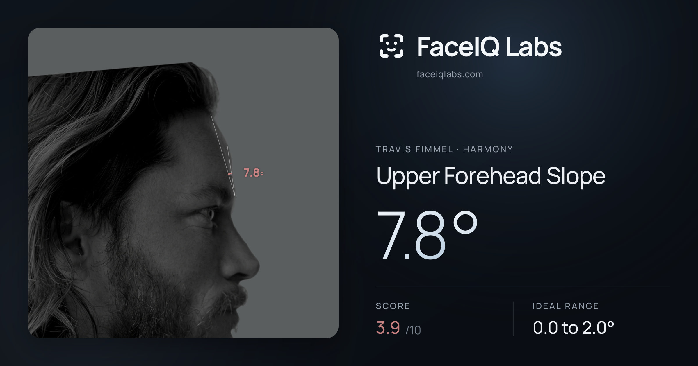 Travis Fimmel Upper Forehead Slope: 7.8°, drawn on the photo