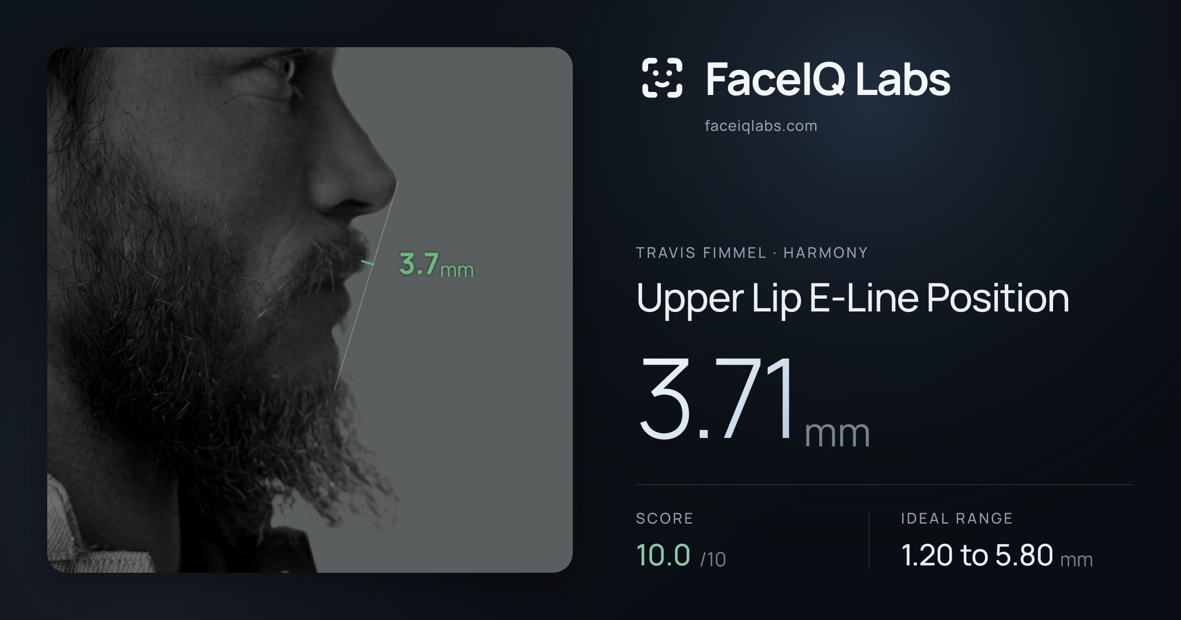 Travis Fimmel Upper Lip E-Line Position: 3.71mm, drawn on the photo