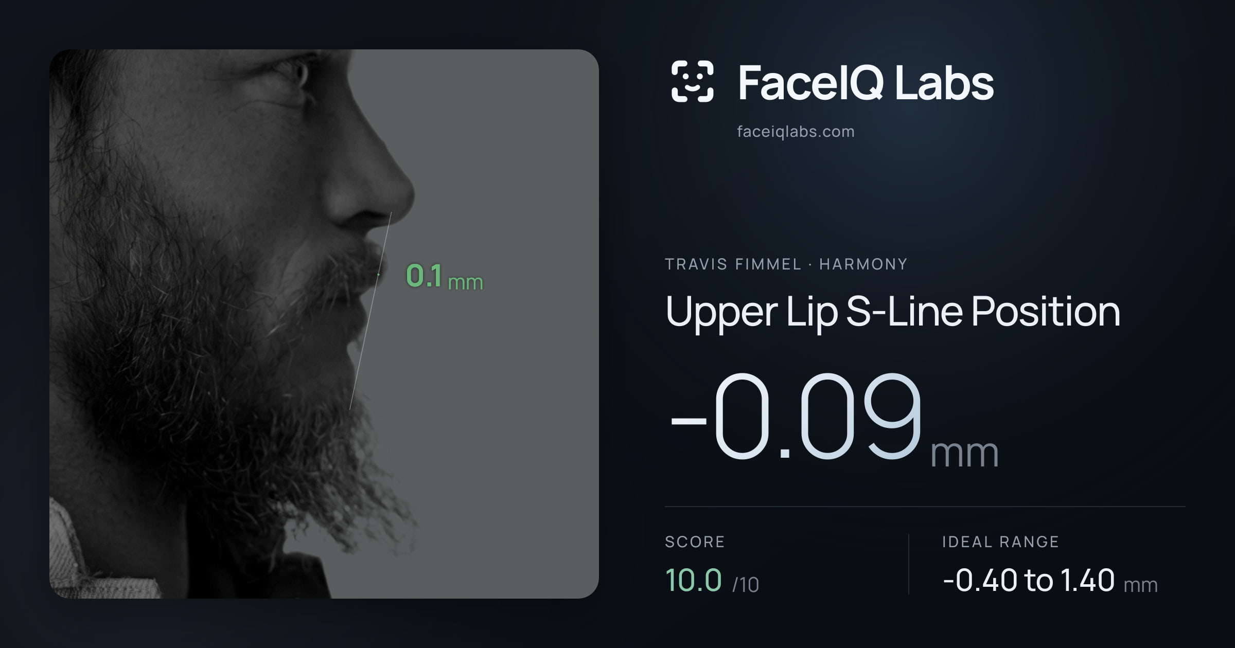 Travis Fimmel Upper Lip S-Line Position: -0.09mm, drawn on the photo