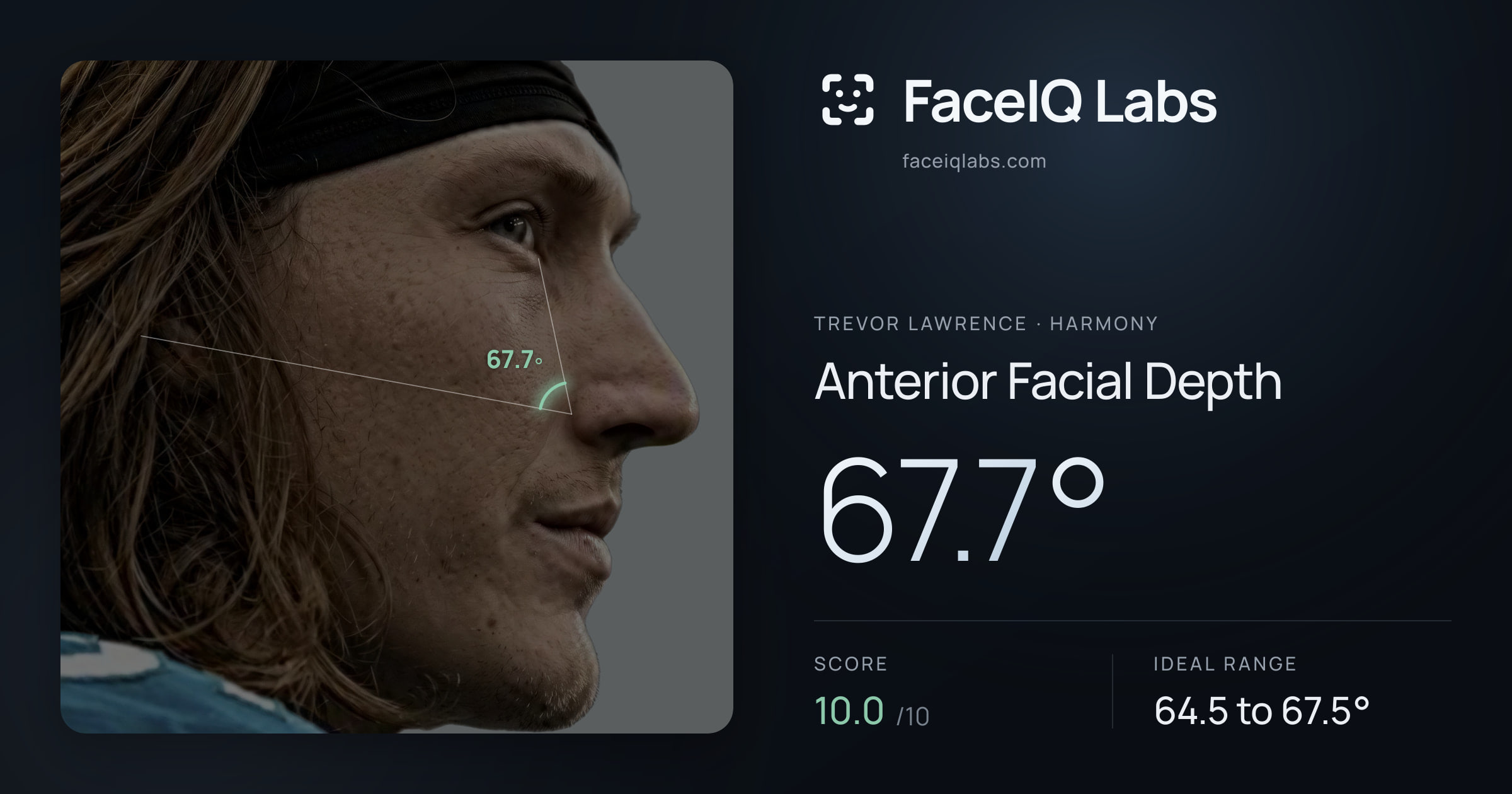 Trevor Lawrence Anterior Facial Depth: 67.7°, drawn on the photo