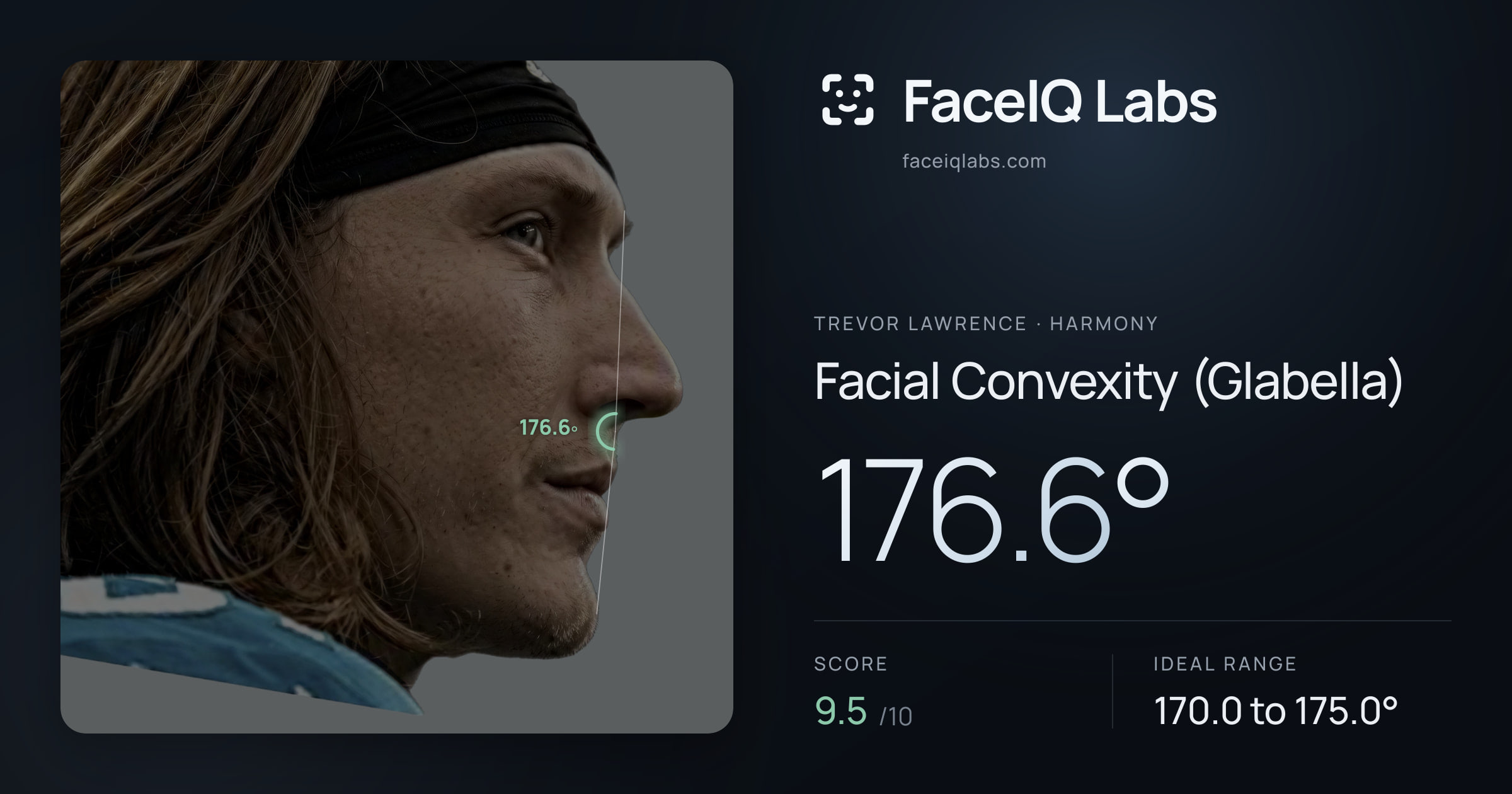 Trevor Lawrence Facial Convexity (Glabella): 176.6°, drawn on the photo