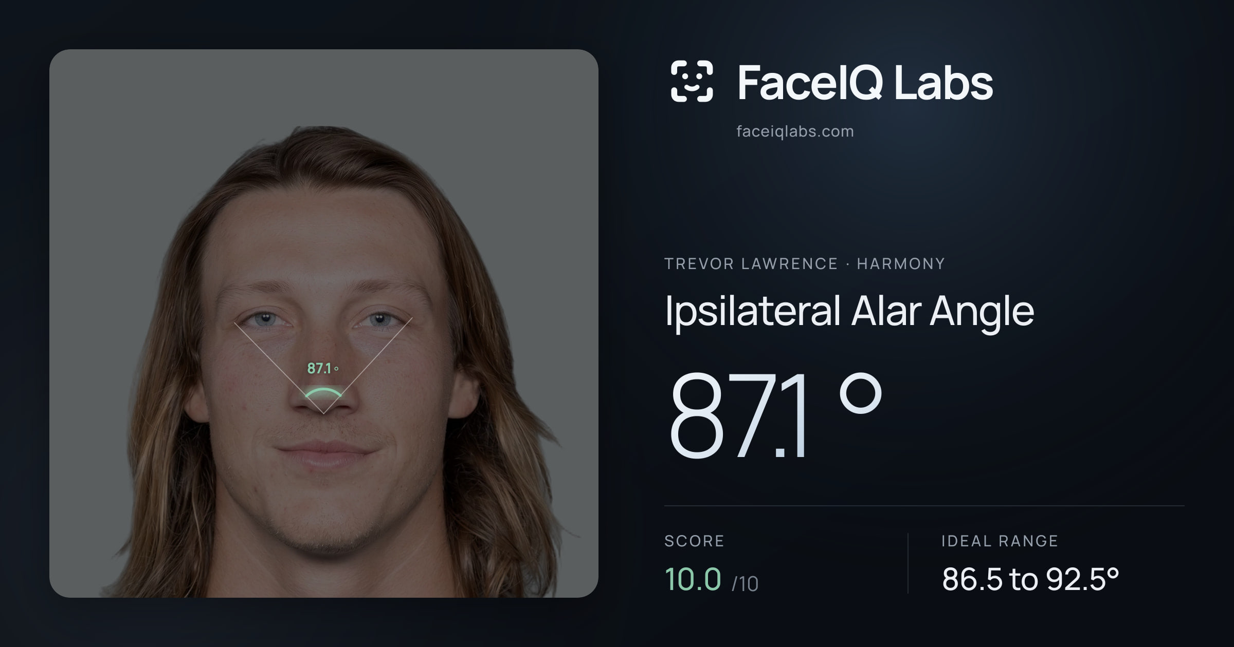Trevor Lawrence Ipsilateral Alar Angle: 87.1°, drawn on the photo