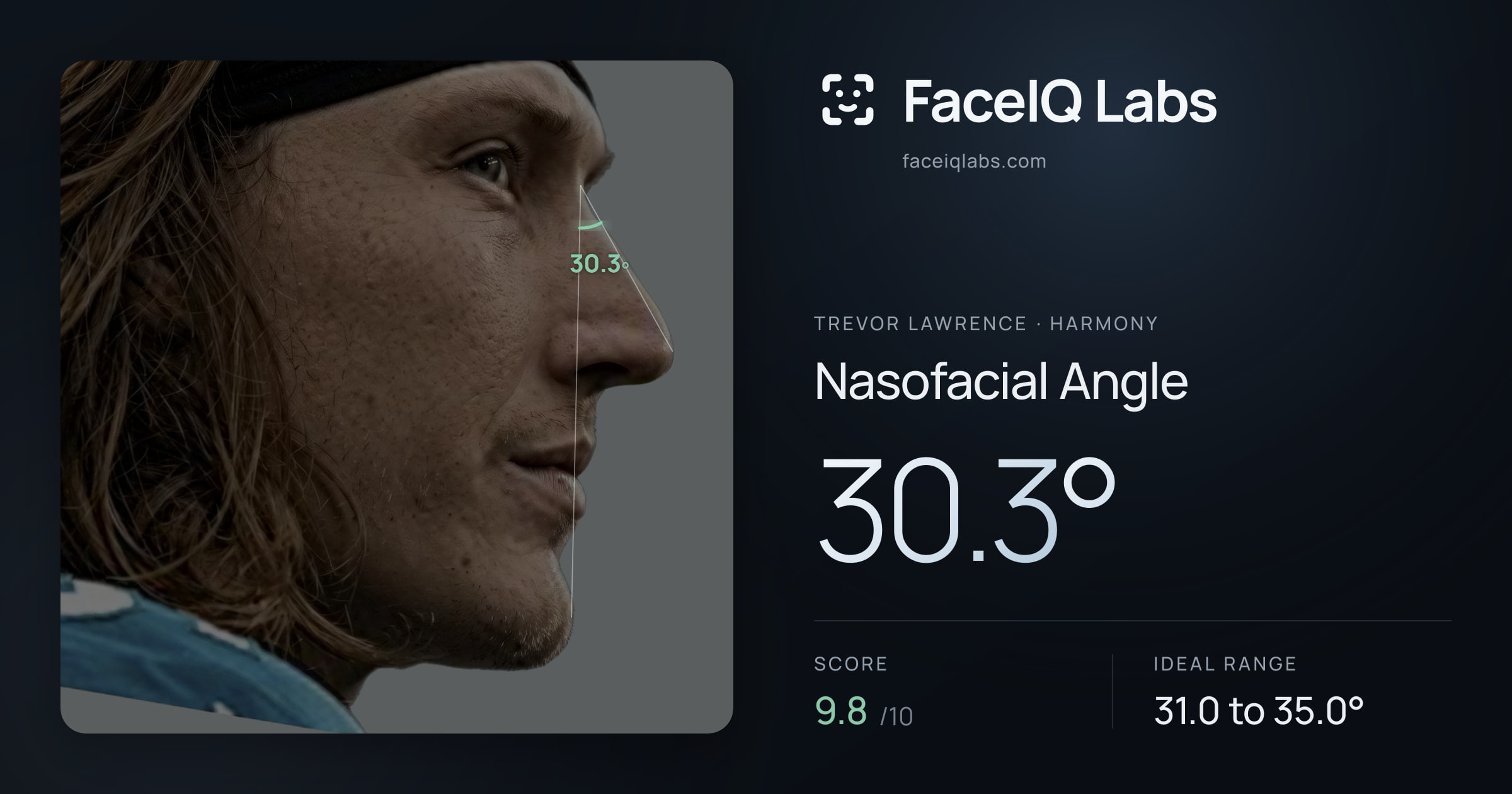 Trevor Lawrence Nasofacial Angle: 30.3°, drawn on the photo