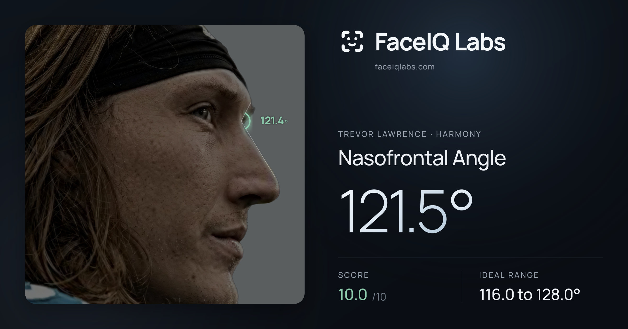 Trevor Lawrence Nasofrontal Angle: 121.5°, drawn on the photo