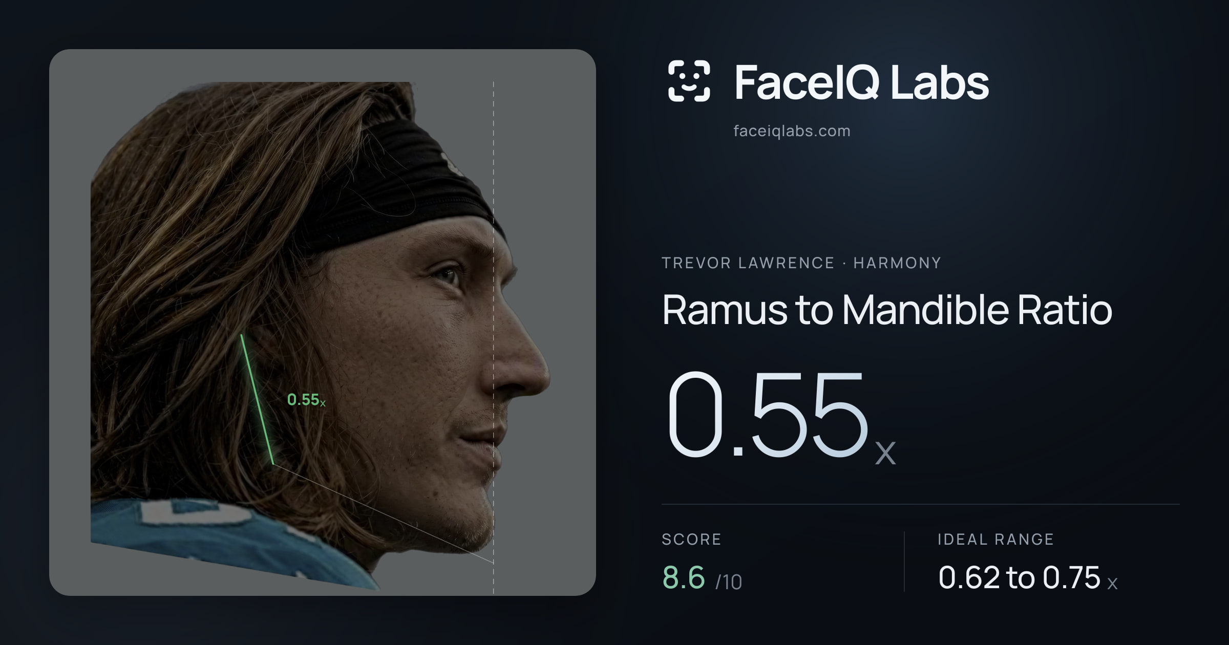 Trevor Lawrence Ramus to Mandible Ratio: 0.55x, drawn on the photo