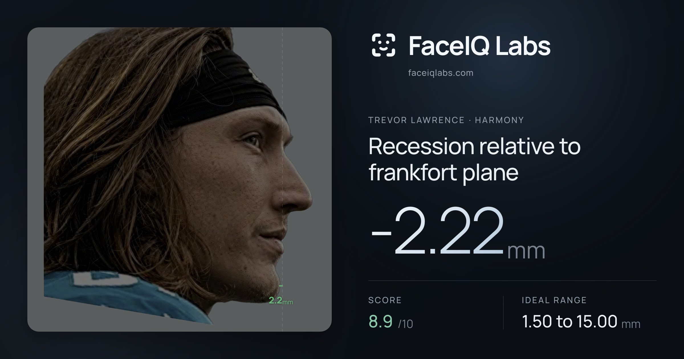 Trevor Lawrence Recession relative to frankfort plane: -2.22mm, drawn on the photo