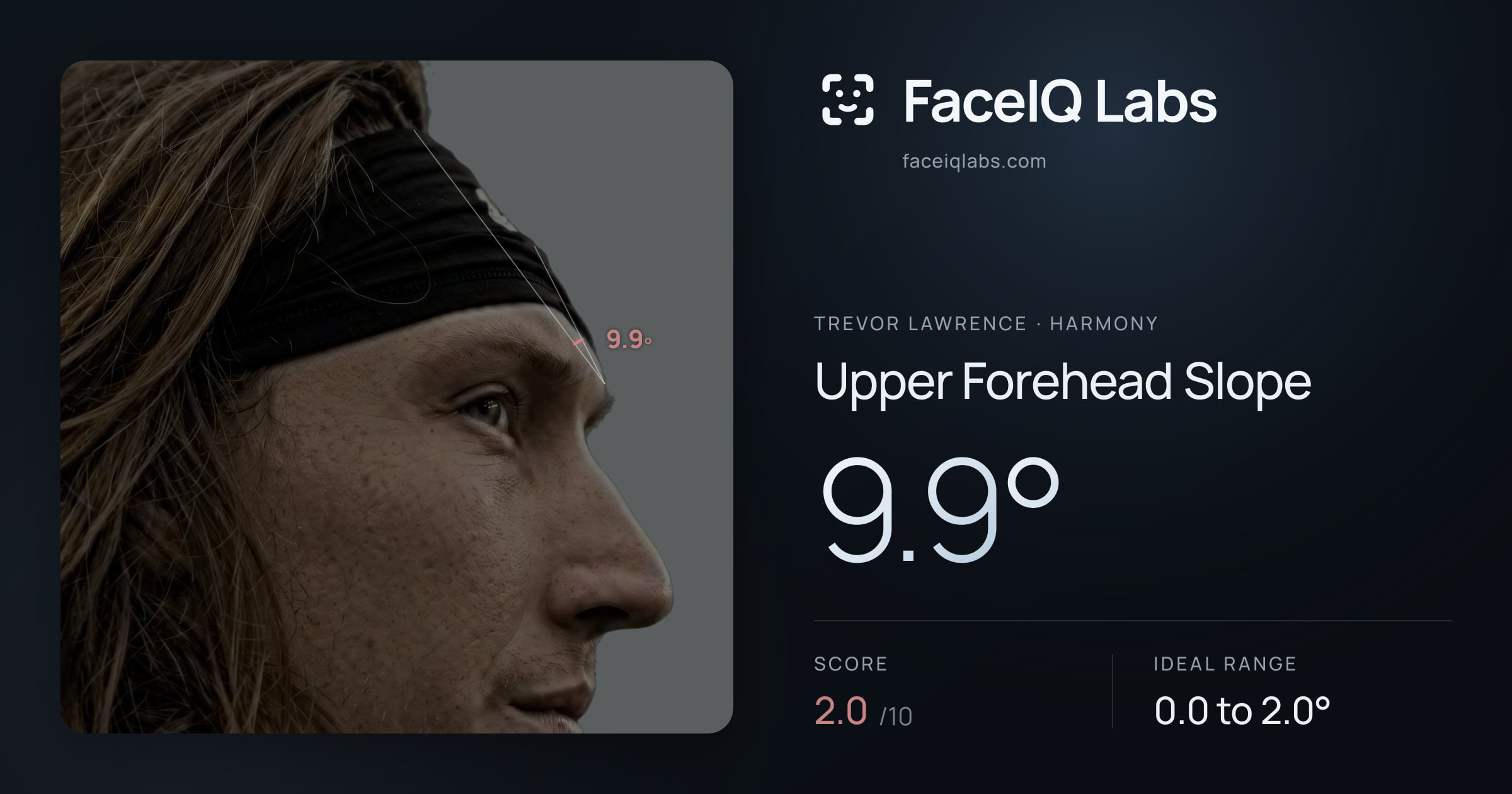 Trevor Lawrence Upper Forehead Slope: 9.9°, drawn on the photo