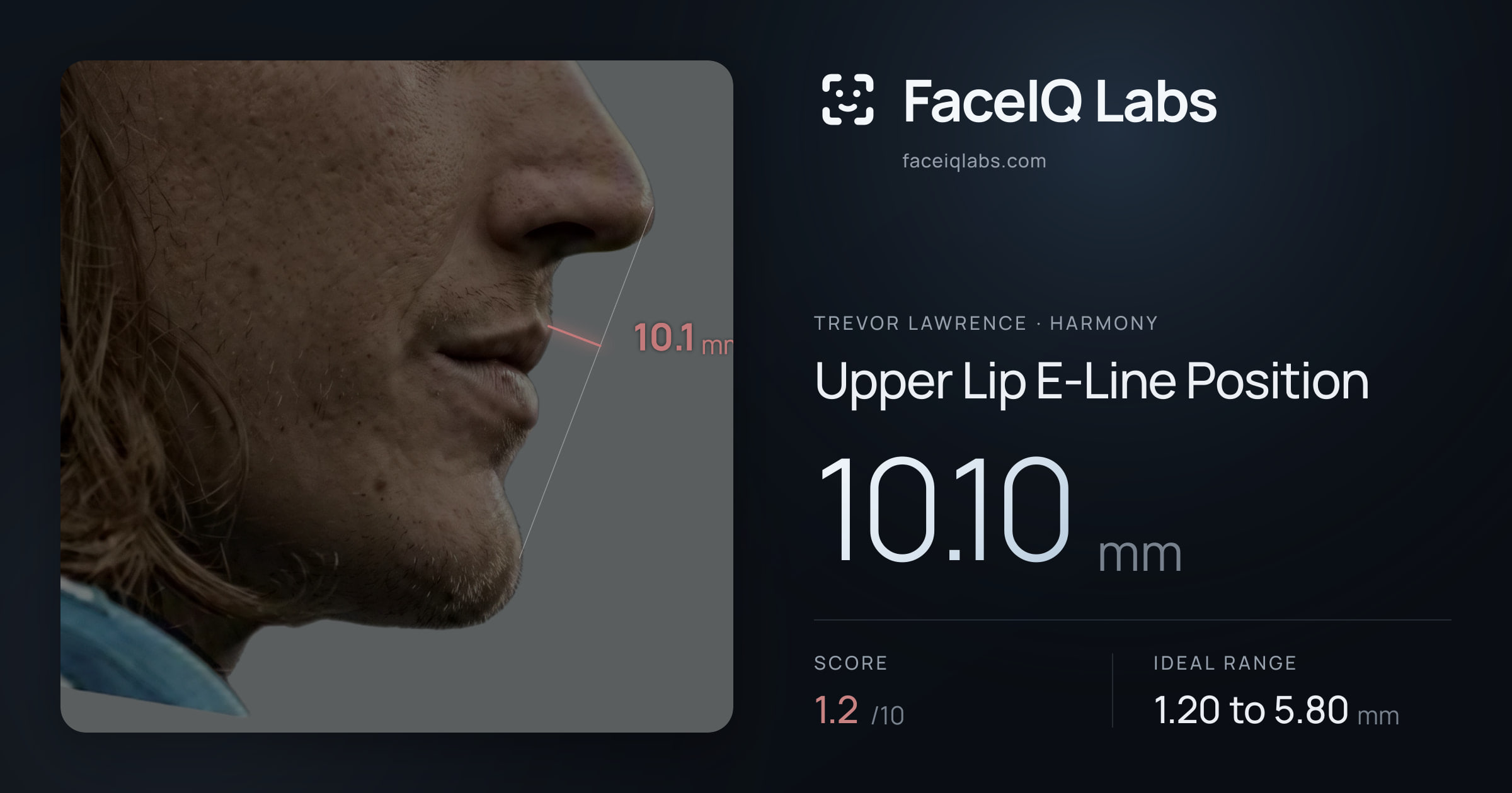 Trevor Lawrence Upper Lip E-Line Position: 10.10mm, drawn on the photo