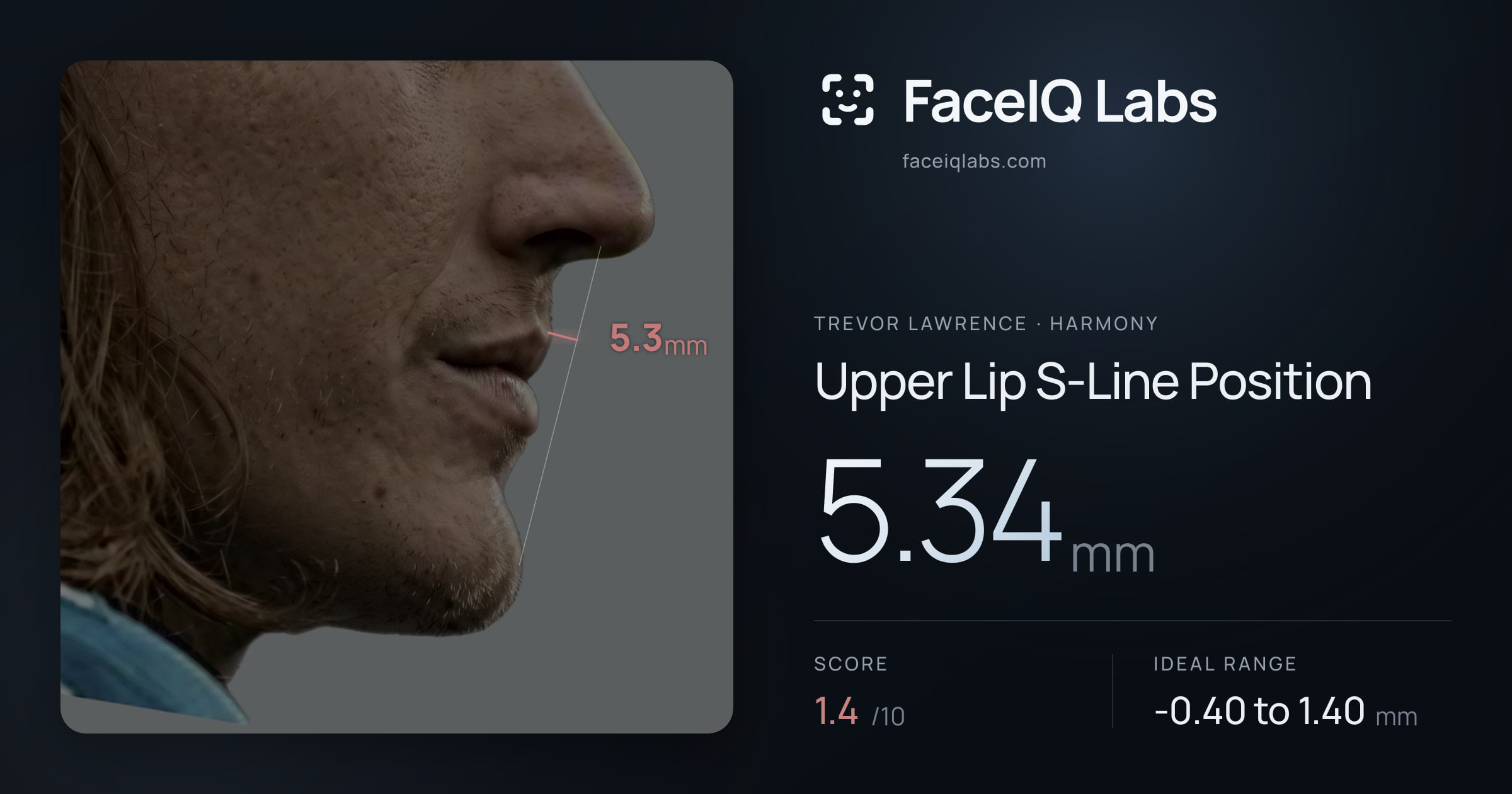 Trevor Lawrence Upper Lip S-Line Position: 5.34mm, drawn on the photo