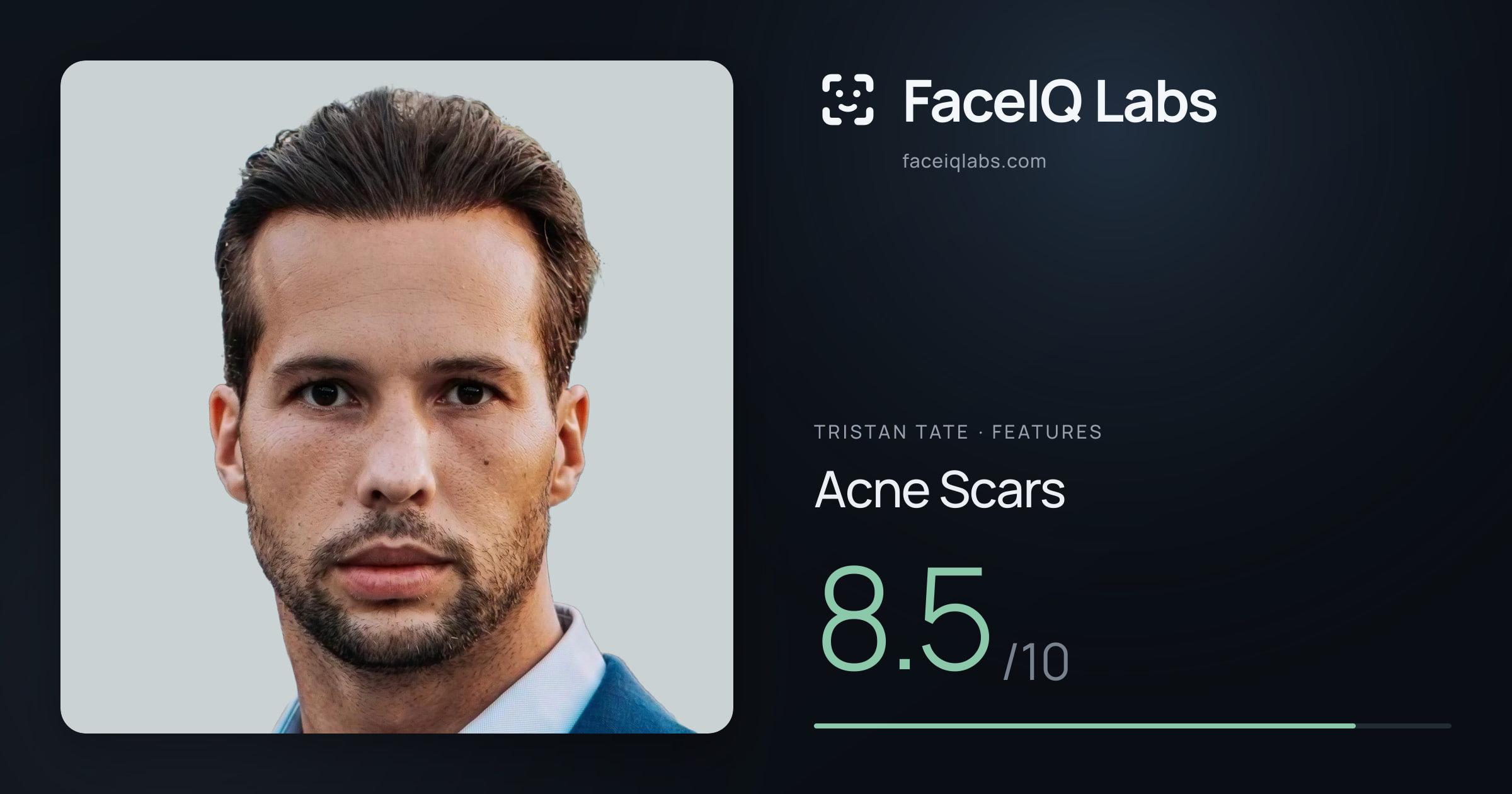 Tristan Tate Acne Scars: 8.5/10, drawn on the photo