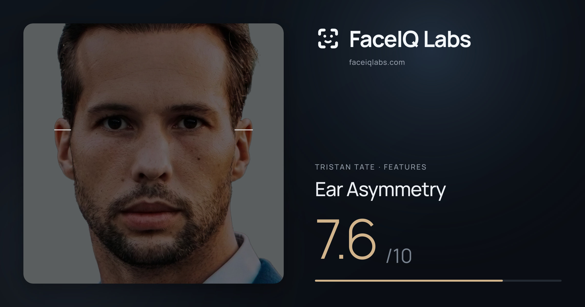 Tristan Tate Ear Asymmetry: 7.6/10, drawn on the photo