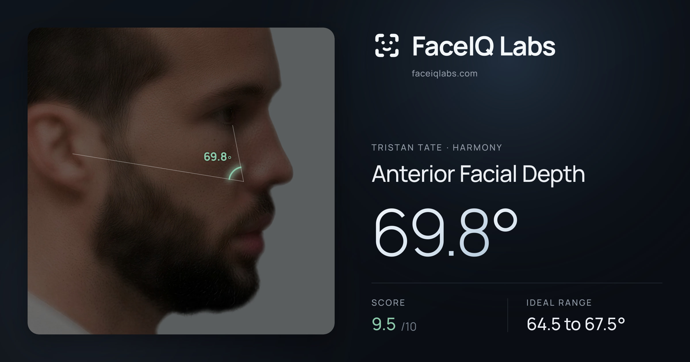 Tristan Tate Anterior Facial Depth: 69.8°, drawn on the photo