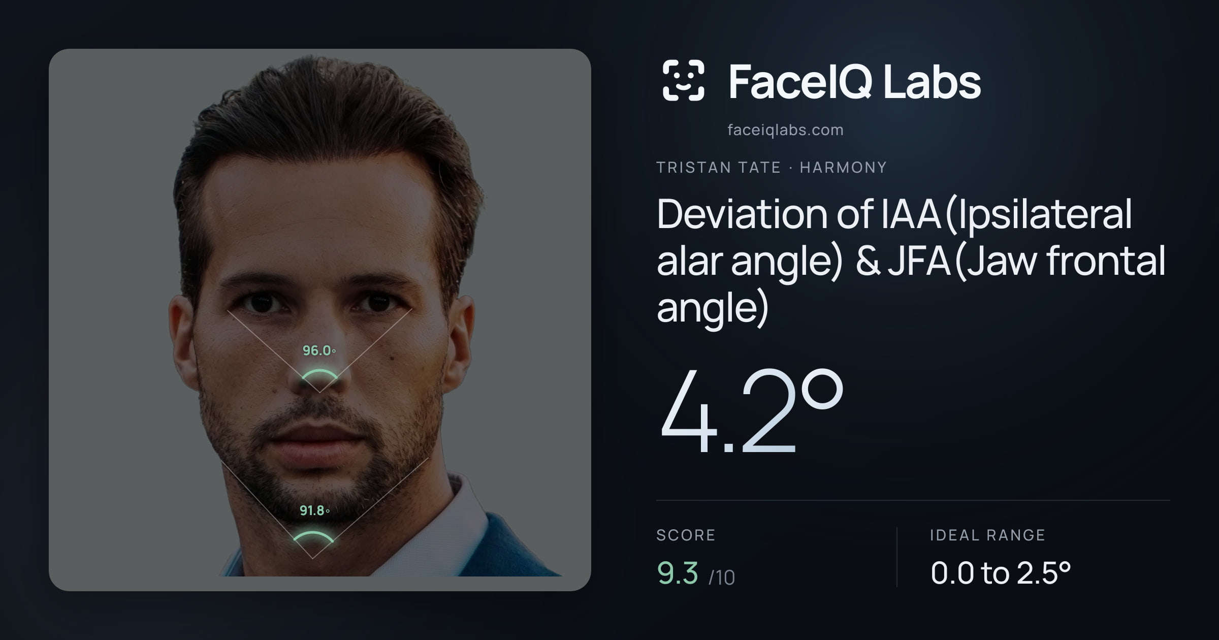 Tristan Tate Deviation of IAA(Ipsilateral alar angle) & JFA(Jaw frontal angle): 4.2°, drawn on the photo