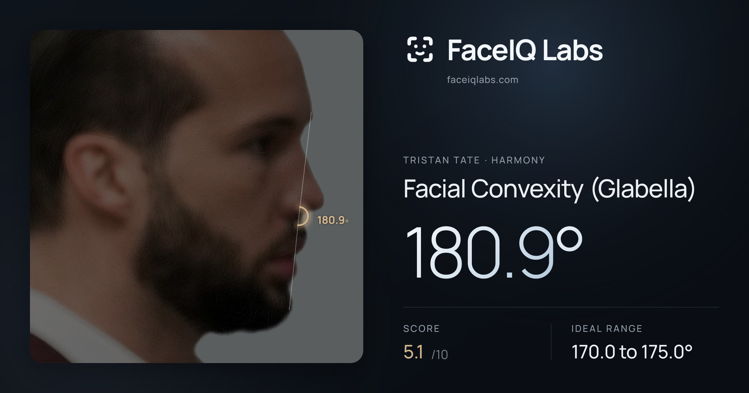 Tristan Tate Facial Convexity (Glabella): 180.9°, drawn on the photo