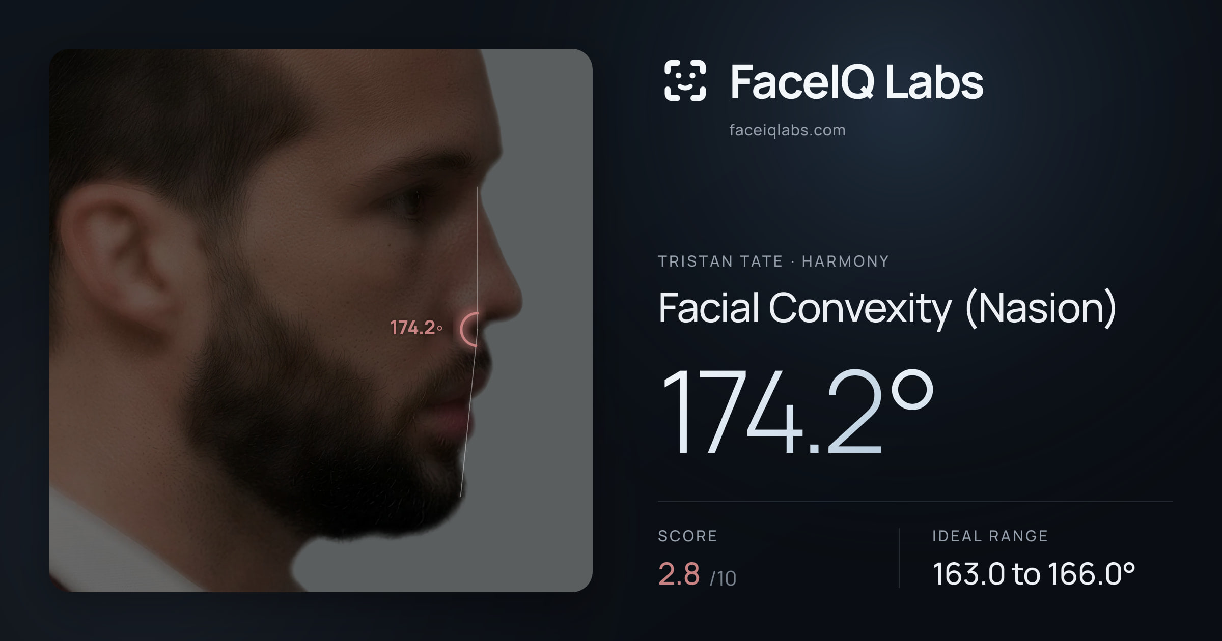 Tristan Tate Facial Convexity (Nasion): 174.2°, drawn on the photo